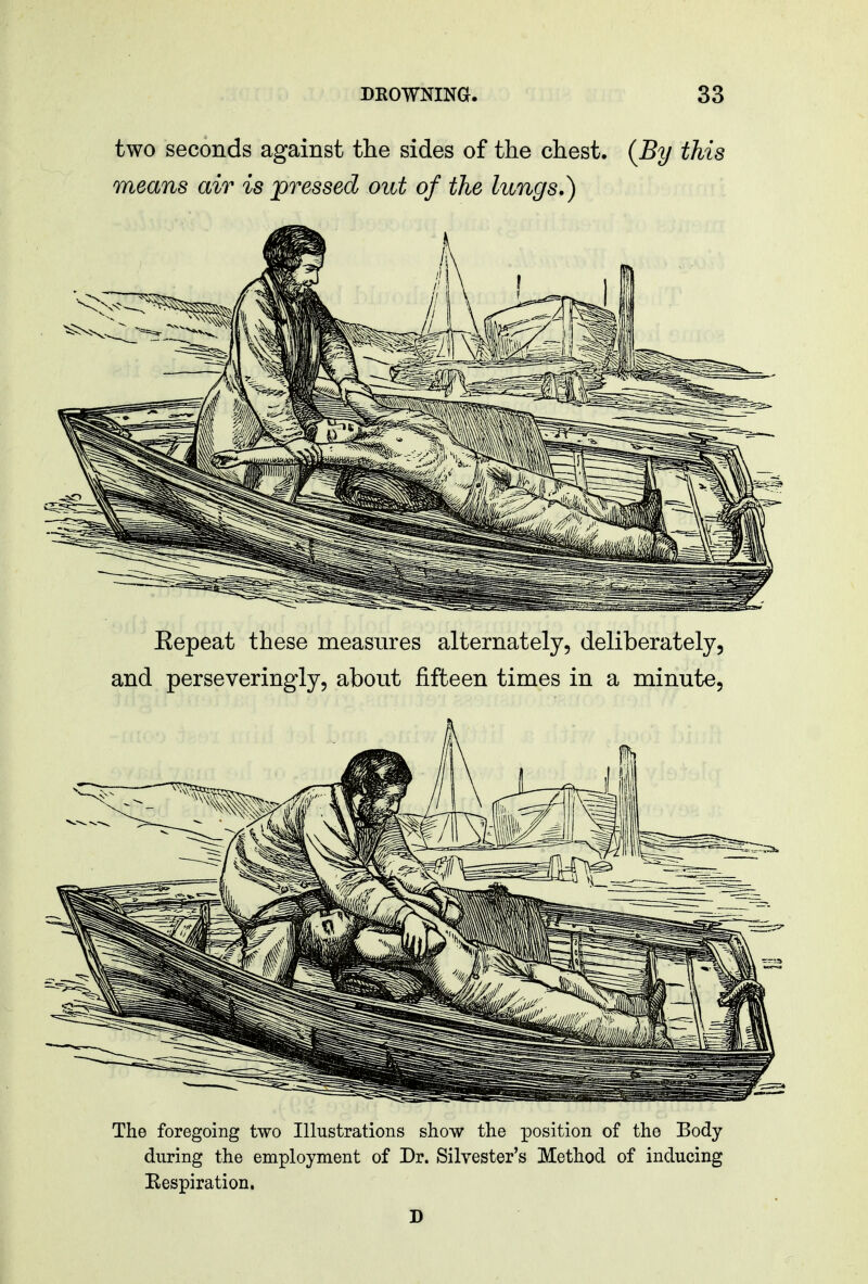 The foregoing two Illustrations show the position of the Body during the employment of Dr. Silvester's Method of inducing Eespiration.