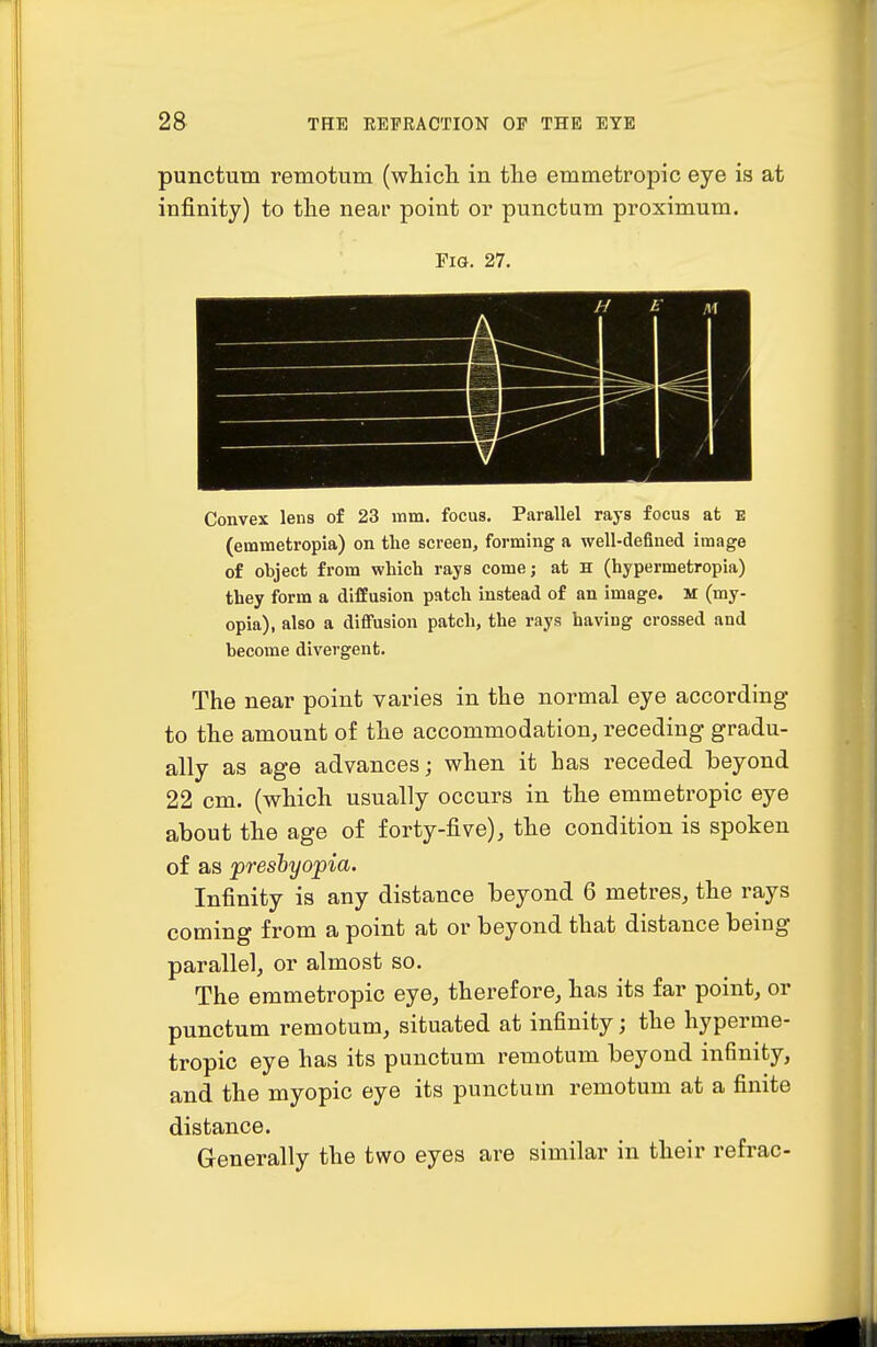 punctum remotum (wliicli in the emmetropic eye is at infinity) to the near point or punctum proximum. Fig. 27. Convex lens of 23 mm. focus. Parallel rays focus at E (emmetropia) on the screen, forming a well-defined image of object from which rays comej at h (hypermetropia) they form a diffusion patch instead of an image. M (my- opia), also a diffusion patch, the rays having crossed and become divergent. The near point varies in the normal eye according to the amount of the accommodation, receding gradu- ally as age advances; when it has receded beyond 22 cm. (which usually occurs in the emmetropic eye about the age of forty-five), the condition is spoken of as presbyopia. Infinity is any distance beyond 6 metres, the rays coming from a point at or beyond that distance being parallel, or almost so. The emmetropic eye, therefore, has its far point, or punctum remotum, situated at infinity; the hyperme- tropic eye has its punctum remotum beyond infinity, and the myopic eye its punctum remotum at a finite distance. Generally the two eyes are similar in their refrac-