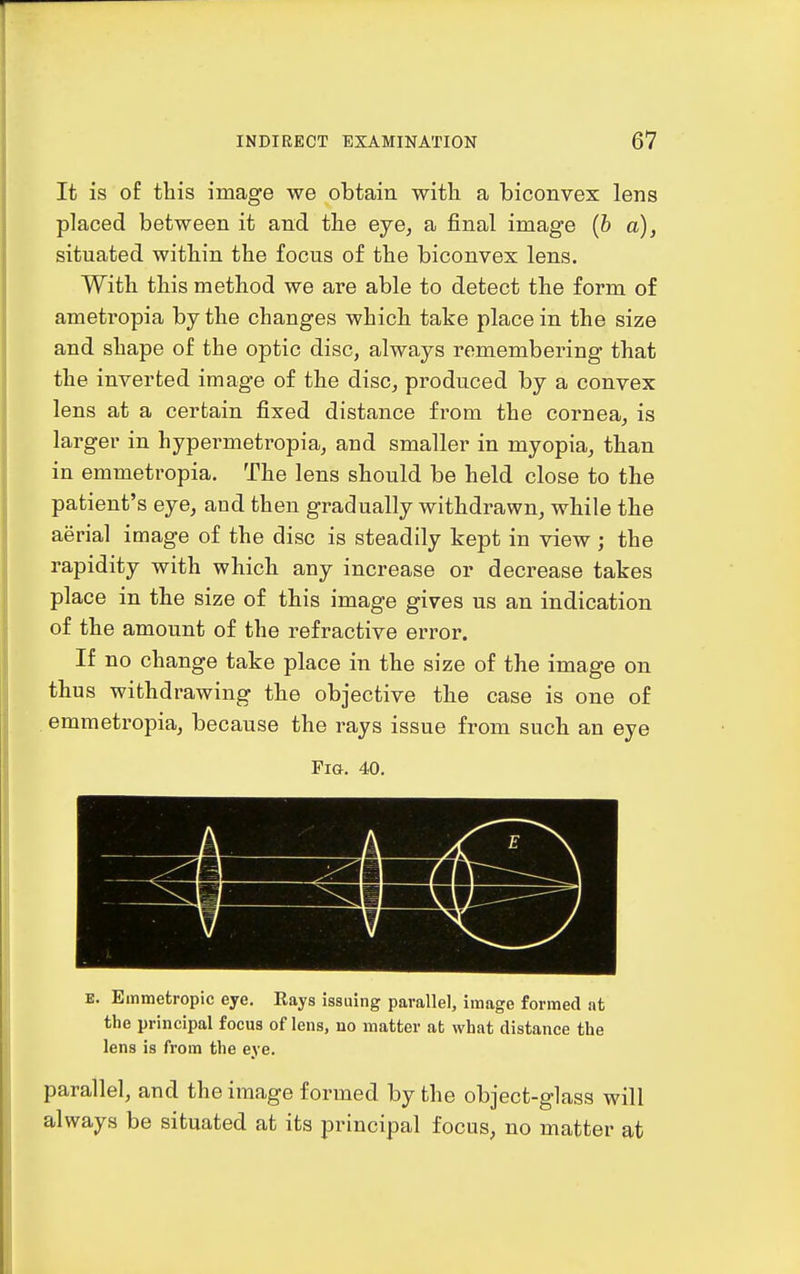 It is of this image we obtain with a biconvex lens placed between it and the eye, a final image (6 a), situated within the focus of the biconvex lens. With this method we are able to detect the form of ametropia by the changes which take place in the size and shape of the optic disc, always remembering that the inverted image of the disc, produced by a convex lens at a certain fixed distance from the cornea, is larger in hypermetropia, and smaller in myopia, than in emmetropia. The lens should be held close to the patient's eye, and then gradually withdrawn, while the aerial image of the disc is steadily kept in view ; the rapidity with which any increase or decrease takes place in the size of this image gives us an indication of the amount of the refractive error. If no change take place in the size of the image on thus withdrawing the objective the case is one of emmetropia, because the rays issue from such an eye Fia. 40. E. Emmetropic eye. Rays issuing parallel, image formed at the principal focus of lens, uo matter at what distance the lens is from the eye. parallel, and the image formed by the object-glass will always be situated at its principal focus, no matter at