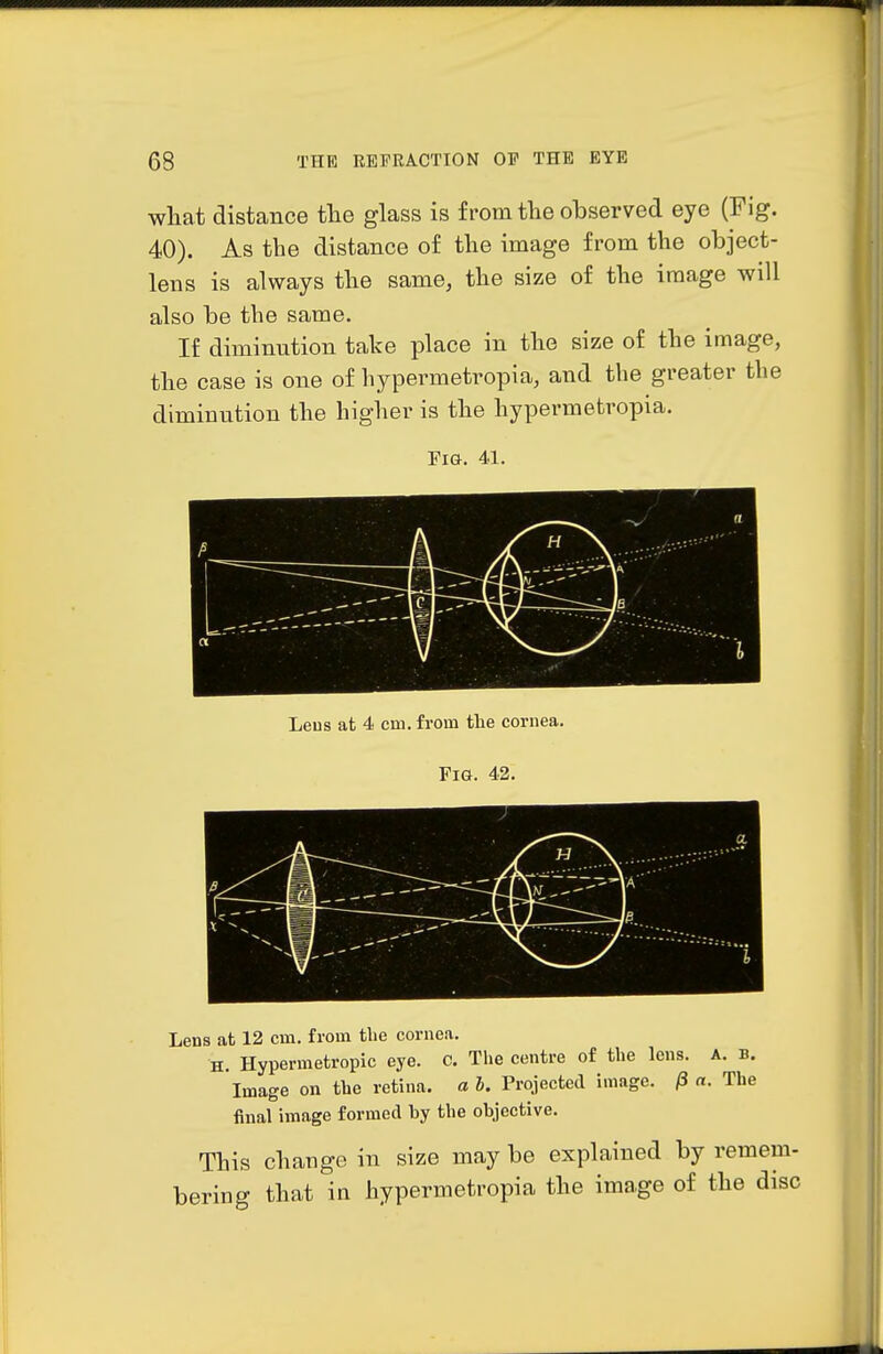 what distance tlie glass is from tlie observed eye (Fig. 40). As the distance of the image from the object- lens is always the same, the size of the image will also be the same. If diminution take place in the size of the image, the case is one of hypermetropia, and the greater the diminution the higher is the hypermetropia. Fia. 41. Leus at 4 cm. from the coi-nea. Fig. 42. a 1 Lens at 12 cm, from the cornea. H. Hypermetropic eye. c. The centre of the lens. A. b. Image on the retina, a I. Projected image. /3 a. The final image formed by the objective. This chaiige in size may be explained by remem- bering that in hypermetropia the image of the disc
