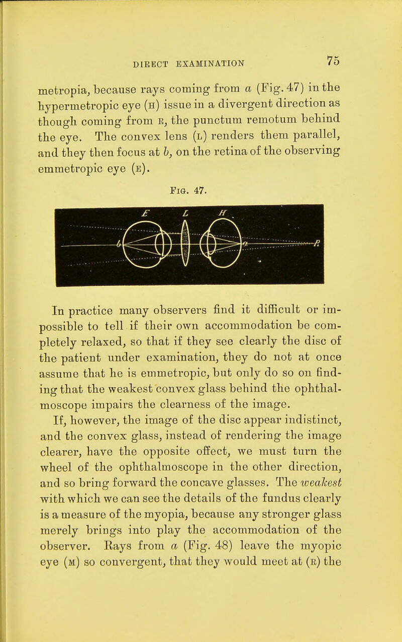 metropia, because rays coming from a (Fig. 47) in the hypermetropic eye (h) issue in a divergent direction as though coming from K, the punctum remotum behind, the eye. The convex lens (l) renders them parallel, and they then focus at h, on the retina of the observing emmetropic eye (e). Fig. 47. In practice many observers find it difficult or im- possible to tell if their own accommodation be com- pletely relaxed, so that if they see clearly the disc of the patient under examination, they do not at once assume that he is emmetropic, but only do so on find- ing that the weakest convex glass behind the ophthal- moscope impairs the clearness of the image. If, however, the image of the disc appear indistinct, and the convex glass, instead of rendering the image clearer, have the opposite effect, we must turn the wheel of the ophthalmoscope in the other direction, and so bring forward the concave glasses. The weakest with which we can see the details of the fundus clearly is a measure of the myopia, because any stronger glass merely brings into play the accommodation of the observer. Rays from a (Fig. 48) leave the myopic eye (m) so convergent, that they would meet at (r) the