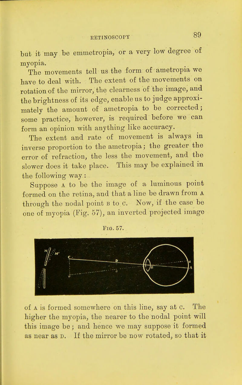 but it may be emmetropia, or a very low degree of myopia. The movements tell us the form of ametropia we have to deal with. The extent of the movements on rotation of the mirror, the clearness of the image, and the brightness of its edge, enable us to judge approxi- mately the amount of ametropia to be corrected; some practice, however, is required before we can form an opinion with anything like accuracy. The extent and rate of movement is always in inverse proportion to the ametropia; the greater the error of refractioa, the less the movement, and the slower does it take place. This may be explained in the following way: Suppose A to be the image of a luminous poiut formed on the retina, and that a line be drawn from A through the nodal point b to c. Now, if the case be one of myopia (Fig. 57), an inverted projected image Fig. 57. of A is formed somewhere on this line, say at c. The higher the myopia, the nearer to the nodal point will this image be; and hence we may suppose it formed as near as d. If the mirror be now rotated, so that it
