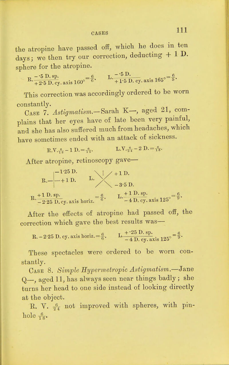 the atropine have passed off, which he does in ten days; we then try our correction, deducting + ID. sphere for the atropine. ^•?SsSy. axis 160°=^- ^'TTSDr^^. axis 165°=-^- This correction was accordingly ordered to be worn constantly. Case 7. Astigmatism—S&vah K—, aged 21, com- plains that her eyes have of late been very painful, and she has also suffered much from headaches, which have sometimes ended with an attack of sickness. After atropine, retinoscopy gave— R.— -1-25 D. \:/+lD. —+ 1D. ^ -3-5 D. 6 -2-25 D.cy.axis horiz. ^' -4D. cy. axis 125 After the effects of atropine had passed off, the correction which gave the best results was— ... R r + 250.80. _6 R. - 2-25 D. cy. axis honz. = f. ^-.4 p. cy. axis 125° These spectacles were ordered to be worn con- stantly. Case 8. Simple Hypermetropic Astigmatism.—Jane Q—^ aged 11, has always seen near things badly; she turns her head to one side instead of looking directly at the object. Y. not improved with spheres, with pin- hole y%.
