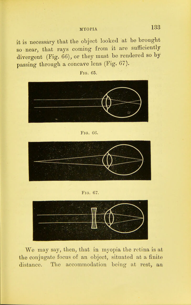 it is necessary tliat the object looked at be brought so near, that rays coming from it are sufl&ciently divergent (Fig. 66), or they must be rendered so by passing through a concave lens (Fig. 67). Fig. 65. We may say, then, that in myopia the retina is at the conjugate focus of an object, situated at a finite distance. The accommodation being at rest, an