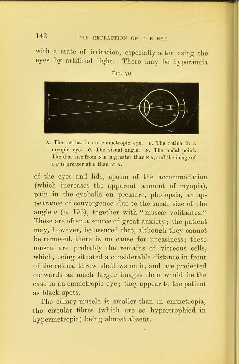 THE REFRACTION OF THE EYE witli a state of irritation, especially after using the eyes by artificial light. There may be hypersemia Fig. 70. A. The retina in an emmetropic eye. B. The retina in a myopic eye. 0. The visual angle. N. The nodal point. The distance from N b is greater than N A, and the image of o p is greater at B than at A. of the eyes and lids, spasm of the accommodation (which increases the apparent amount of myopia), pain in the eyeballs on pressure, photopsia, an ap- pearance of convergence due to the small size of the angle a (p. 195), together with muscEe volitantes. These are often a source of great anxiety; the patient may, however, be assured that, although they cannot be removed, there is no cause for uneasiness; these muscffi are probably the remains of vitreous cells, which, being situated a considerable distance in fro at of the retina, throAV shadows on it, and are pi'ojected outwards as much larger images than would be the case in an emmetropic eye; they appear to the patient as black spots. The ciliary muscle is smaller than in emmetropia, the circular fibres (which are so hypertrophied in hypermetropia) being almost absent.