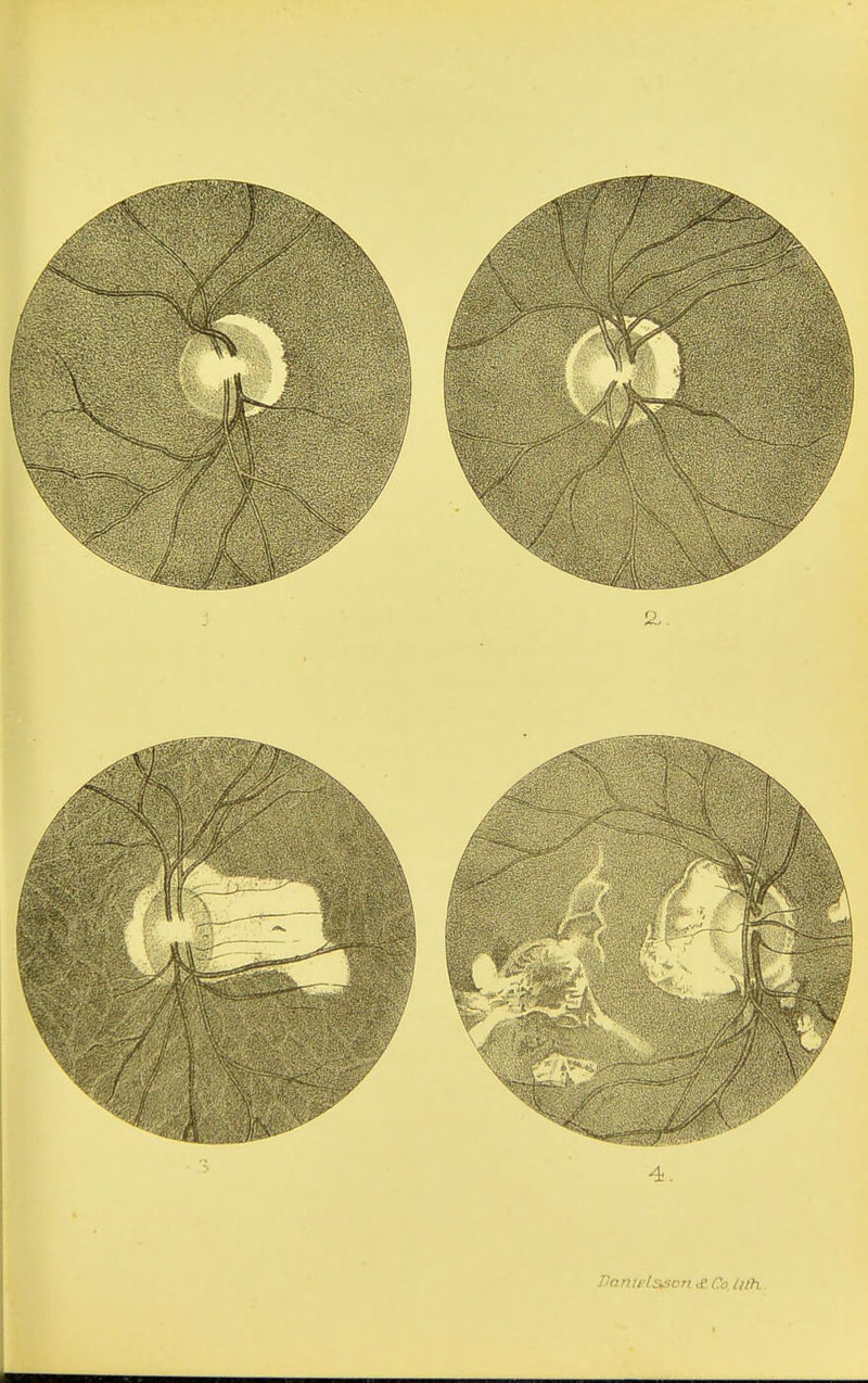 DonteLsfion £ Co. lith