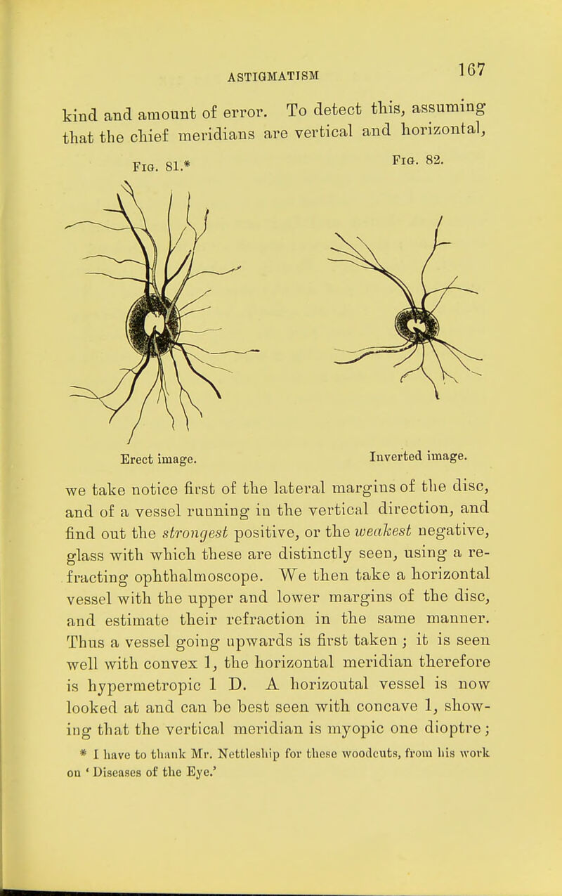 kind and amount of error. To detect this, assuming that the chief meridians are vertical and horizontal. Fig. 81* Fig. 82. Erect image. Inverted image. we take notice first of the lateral margins of the disc, and of a vessel running in the vertical direction, and find out the strongest positive, or the weakest negative, glass with which these are distinctly seen, using a re- fracting ophthalmoscope. We then take a horizontal vessel with the upper and lower margins of the disc, and estimate their refraction in the same manner. Thus a vessel going upwards is first taken ; it is seen well with convex 1, the horizontal meridian therefore is hypermetropic 1 D. A horizontal vessel is now looked at and can he best seen with concave 1, show- ing that the vertical meridian is myopic one dioptre; * I have to thiiiik Mr. Nettlesliip for these woodcuts, from his woi-k ou ' Diseases of the Eye.'