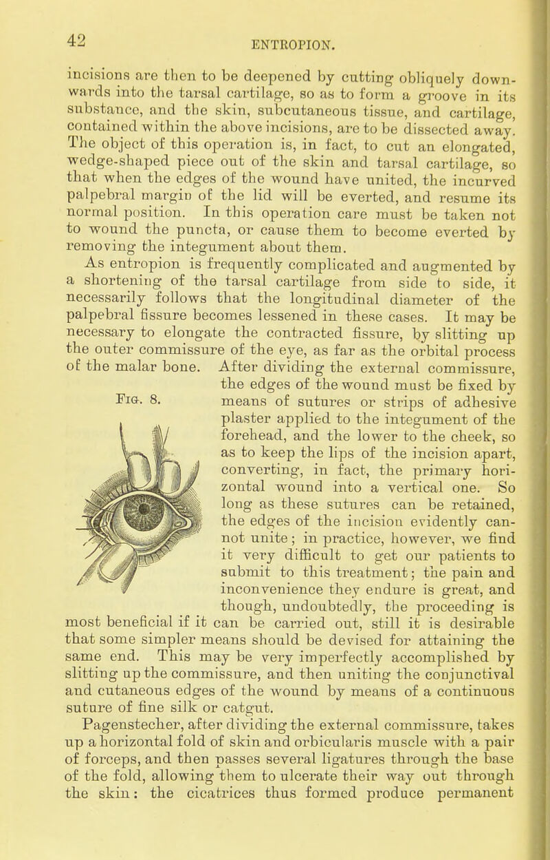 incisions are then to be deepened by cutting obliquely down- wards into the tarsal cartilage, so as to form a groove in its substance, and the skin, subcutaneous tissue, and cartilage, contained within the above incisions, are to be dissected away. The object of this operation is, in fact, to cut an elongated, wedge-shaped piece out of the skin and tarsal cartilage, so that when the edges of the wound have united, the incurved palpebral margin of the lid will be everted, and resume its normal position. In this operation care must be taken not to wound the puncta, or cause them to become everted by removing the integument about them. As entropion is frequently complicated and augmented by a shortening of the tarsal cartilage from side to side, it necessarily follows that the longitudinal diameter of the palpebral fissure becomes lessened in these cases. It may be necessary to elongate the contracted fissure, by slitting up the outer commissure of the eye, as far as the orbital process of the malar bone. After dividing the external commissure, the edges of the wound must be fixed by Fig. 8. means of sutures or strips of adhesive plaster applied to the integument of the forehead, and the lower to the cheek, so as to keep the lips of the incision apart, converting, in fact, the primary hori- zontal wound into a vertical one. So long as these sutures can be retained, the edges of the incision evidently can- not unite ; in practice, however, we find it very difficult to get our patients to submit to this treatment; the pain and inconvenience they endure is great, and though, undoubtedly, the proceeding is most beneficial if it can be carried out, still it is desirable that some simpler means should be devised for attaining the same end. This may be very imperfectly accomplished by slitting up the commissure, and then uniting the conjunctival and cutaneous edges of the wound by means of a continuous suture of fine silk or catgut. Pagenstecher, after dividing the external commissure, takes up a horizontal fold of skin and orbicularis muscle with a pair of forceps, and then passes several ligatures through the base of the fold, allowing them to ulcerate their way out through the skin: the cicatrices thus formed produce permanent