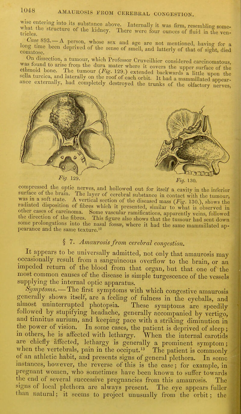 AMAUROSIS PROM CEREBRAL CONGESTION. wi,atThTlllcto.J'nf-^'1 M '^''^r. fi™' resembling some- nicies, ^''^ey- -Tliere were four ounces of fluid in the ven- Inn^T ^^^^^ '^'^ age are not mentioned, havin<^ for a comatose'  ^''^ ^'^^ ^'''^y «^ ^'^^^ «^ ^'g'^t' ^^^^'i wn?f,nIiT?'°'  ^'•'i'/' Professor Cruveilhier considered carcinomatous, was tound to arise from the dura mater where it covers the upper surface of the ethmoid bone. The tumour (Fig. 129.) extended backwnrds'^^ little upon he .ella turcica, and aterally on the roof of each orbit. It had a mammiUated ™r! ance externally, had completely destroyed the trunks of the olfactory neVves Fig. 129. compressed the optic nerves, and hollowed out for Itself a cavity in the inferior surface of the brain. The layer of cerebral substance in contact with the tumour, was in a soft state. A vertical section of the diseased mass (Fig. 130.), shows the radiated disposition of fibres which it presented, similar to what is observed in other cases of carcinoma. Some vascular ramifications, apparently veins, followed the direction of the fibres. This figure also shows that the tumour had sent down some prolongations into the nasal fossjB, where it had the same mammillated ap- pearance and the same texture.^^ § 7. Amaurosis from cerebral congestion. It appears to be universally admitted, not only that amaurosis may occasionally result from a sanguineous overflow to the brain, or an impeded return of the blood from that organ, but that one of the most common causes of the disease is simple turgescence of the vessels supplying the internal optic apparatus. Symptoms. — The first symptoms with which congestive amaurosis generally shows itself, are a feeling of fulness in the eyeballs, and almost uninterrupted photopsia. These symptoms are speedily followed_ by stupifying headache, generally accompanied by vertigo, and tinnitus aurium, and keeping pace with a striking diminution in the power of vision. In some cases, the patient is deprived of sleep; in others, he^ is affected with lethargy. When the internal carotids are chiefly affected, lethargy is generally a prominent symptom; when the vertebrals, pain in the occiput.^^ The patient is commonly of an athletic habit, and presents signs of general plethora. In some instances, however, the reverse of this is the case; for example, in pregnant women, who sometimes have been known to suflfer towards the end of several successive pregnancies from this amaurosis. The signs of local plethora are always present. The eye appears fuller than natural; it seems to project unusually from the orbit; the
