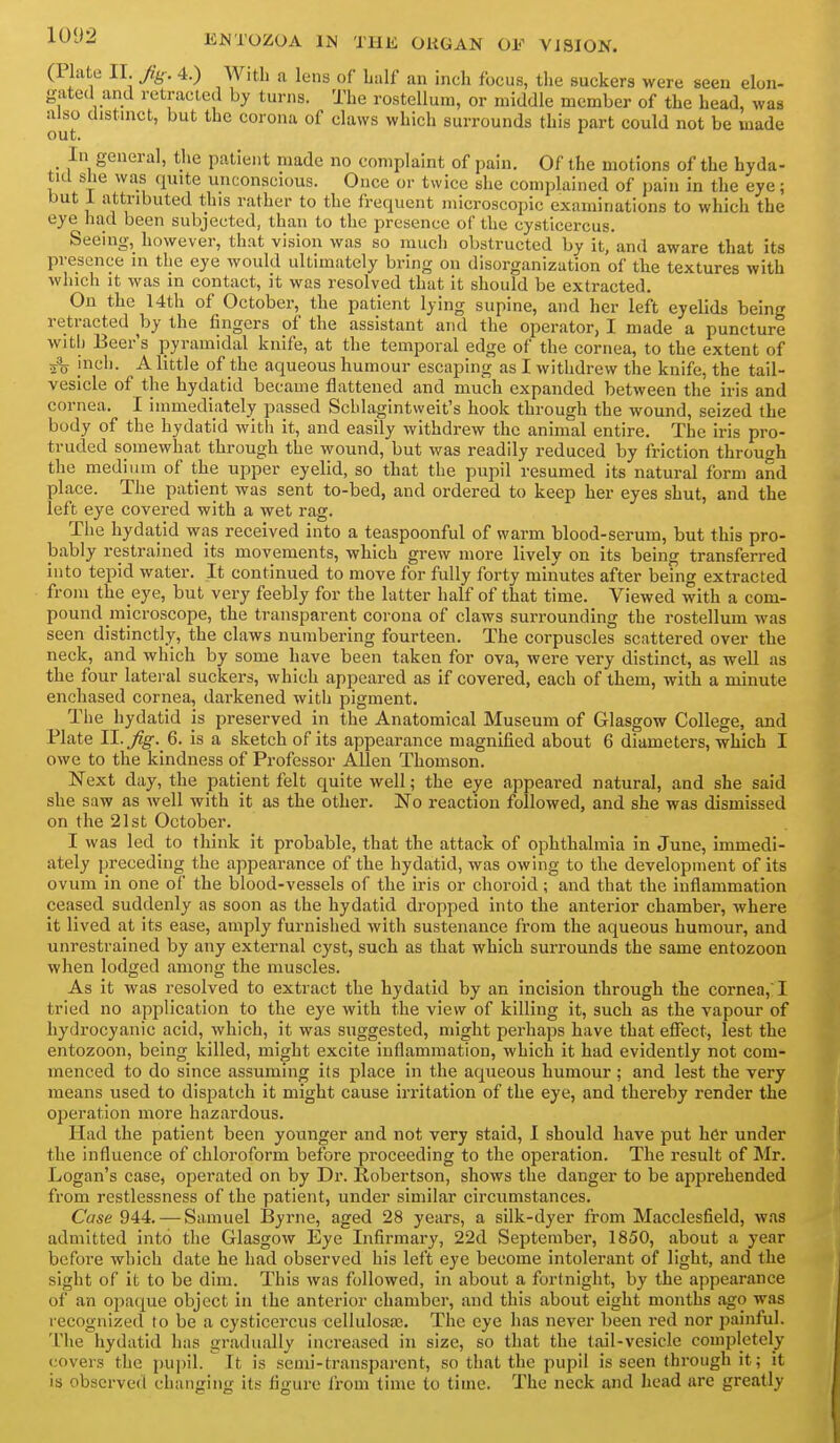 (Plate II Jig: 4.) With a lens of half an inch focus, the suckers were seen elon- gatecl and retracted by turns. The rostelluin, or middle member of the head, was also distmct, but the corona of claws which surrounds this part could not be made out. *^ In general, the patient made no complaint of pain. Of the motions of the hyda- tid she was quite unconscious. Once or twice she complained of j)ain in the eye; but i attributed this rather to the frequent microscopic examinations to which the eye had been subjected, than to the presence of the cysticercus. Seeing, however, that vision was so much obstructed by it, and aware that its presence in the eye would ultimately bring on disorganization of the textures with which it was in contact, it was resolved that it should be extracted. On the 14th of October, the patient lying supine, and her left eyelids being retracted by the fingers of the assistant and the operator, I made a puncture with Beer's pyramidal knife, at the temporal edge of the cornea, to the extent of ■io inch. A little of the aqueous humour escaping as I withdrew the knife, the tail- vesicle of the hydatid became flattened and much expanded between the iris and cornea. I immediately passed Scblagintweit's hook through the wound, seized the body of the hydatid with it, and easily withdrew the animal entire. The iris pro- truded somewhat through the wound, but was readily reduced by friction through the medium of the upper eyelid, so that the pupil resumed its natural form and place. The patient was sent to-bed, and ordered to keep her eyes shut, and the left eye covered with a wet rag. The hydatid was received into a teaspoonful of warm blood-serum, but this pro- bably restrained its movements, which grew more lively on its being transferred into tepid water. It continued to move for fully forty minutes after being extracted from the eye, but very feebly for the latter half of that time. Viewed with a com- pound microscope, the transparent corona of claws surrounding the rostellum was seen distinctly, the claws numbering fourteen. The corpuscles scattered over the neck, and which by some have been taken for ova, were very distinct, as well as the four lateral suckers, which appeared as if covered, each of them, with a minute enchased cornea, darkened with pigment. The hydatid is preserved in the Anatomical Museum of Glasgow College, and Plate 11. Jig. 6. is a sketch of its appearance magnified about 6 diameters, which I owe to the kindness of Professor Allen Thomson. Next day, the patient felt quite well; the eye appeared natural, and she said she saw as Avell with it as the other. No reaction followed, and she was dismissed on the 21st October. I was led to think it probable, that the attack of ophthalmia in June, immedi- ately preceding the appearance of the hydatid, was owing to the development of its ovum in one of the blood-vessels of the iris or choroid; and that the inflammation ceased suddenly as soon as the hydatid dropped into the anterior chamber, where it lived at its ease, amply furnished with sustenance from the aqueous humour, and unrestrained by any external cyst, such as that which surrounds the same entozoon when lodged among the muscles. As it was resolved to extract the hydatid by an incision through the cornea,' I tried no application to the eye with the view of killing it, such as the vapour of hydrocyanic acid, which, it was suggested, might perhaps have that effect, lest the entozoon, being killed, might excite inflammation, which it had evidently not com- menced to do since assuming its place in the aqueous humour; and lest the very means used to disjjatch it might cause irritation of the eye, and thereby render the operation more hazardous. Had the patient been younger and not very staid, I should have put her under the influence of chloroform before proceeding to the operation. The result of Mr. Logan's case, operated on by Dr. Robertson, shows the danger to be apprehended from restlessness of the patient, under similar circumstances. Case 944. — Samuel IByrne, aged 28 years, a silk-dyer from Macclesfield, was admitted into the Glasgow Eye Infirmary, 22d September, 1850, about a year before which date he had observed his left eye become intolerant of light, and the sight of It to be dim. This was followed, In about a fortnight, by the appearance of an opaque object In the anterior chamber, and this about eight months ago was recognized to be a cysticercus cellulosa3. The eye has never been red nor painful. The hydatid has gradually increased in size, so that the tail-vesicle completely covers the pupil. It is semi-transparent, so that the pupil is seen through it; it is observed changing its figure Irom time to time. The neck and head are greatly