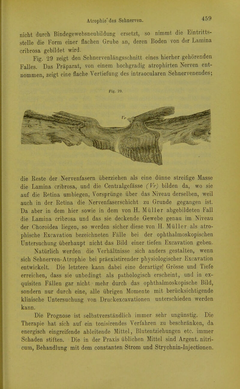 nicht durch Bindegewebsneubildung ersetzt, so nimmt die Eintritts- stelle die Form einer flachen Grube an, deren Boden von der Lamina cribrosa gebildet wird. Fig. 29 zeigt den Sehnervenlängsschnitt eines hierher gehörenden Falles. Das Präparat, von einem hochgradig atrophirten Nerven ent- nommen, zeigt eine flache Vertiefung des intraoeularen Sehnervenendes; Fig. 29. die Reste der Nervenfasern überziehen als eine dünne streifige Masse die Lamina cribrosa, und die Centralgefässe (Vr) bilden da, wo sie auf die Retina umbiegen, Vorsprünge über das Niveau derselben, weil auch in der Retina die Nervenfaserschicht zu Grunde gegangen ist. Da aber in dem hier sowie in dem von H. Müller abgebildeten Fall die Lamina cribrosa und das sie deckende Gewebe genau im Niveau der Choroidea liegen, so werden sicher diese von H. Müller als atro- phische Excavation bezeichneten Fälle bei der ophthalmoskopischen Untersuchung überhaupt nicht das Bild einer tiefen Excavation geben. Natürlich werden die Verhältnisse sich anders gestalten, wenn sich Sehnerven-Atrophie bei präexistirender physiologischer Excavation entwickelt. Die letztere kann dabei eine derartige) Grösse und Tiefe erreichen, dass sie unbedingt als pathologisch erscheint, und in ex- quisiten Fällen gar nicht ■ mehr durch das ophthalmoskopische Bild, sondern nur durch eine, alle übrigen Momente mit berücksichtigende klinische Untersuchung von Druckexcavationen unterschieden werden kann. Die Prognose ist selbstverständlich immer sehr ungünstig. Die Therapie hat sich auf ein tonisirendes Verfahren zu beschränken, da energisch eingreifende ableitende Mittel, Blutentziehungen etc. immer Schaden stiften. Die in der Praxis üblichen Mittel sind Argent. nitri- cum, Behandlung mit dem constanten Strom und Strychnin-Injectioncn.