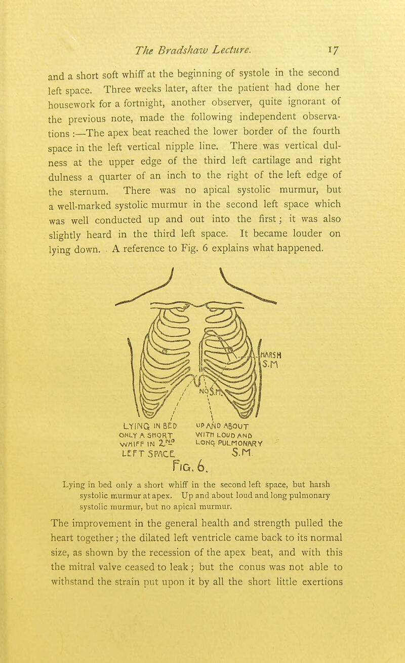 and a short soft whiff at the beginning of systole in the second left space. Three weeks later, after the patient had done her housework for a fortnight, another observer, quite ignorant of the previous note, made the following independent observa- tions : The apex beat reached the lower border of the fourth space in the left vertical nipple line. There was vertical dul- ness at the upper edge of the third left cartilage and right dulness a quarter of an inch to the right of the left edge of the sternum. There was no apical systolic murmur, but a well-marked systolic murmur in the second left space which was well conducted up and out into the first; it was also slightly heard in the third left space. It became louder on lying down. A reference to Fig. 6 explains what happened. - ^ j . w ■ LYINQ IN BED up and ABOUT ONLY A SHORT WITH LOUD AND Wrtlf F IN ZN~° PULMONARY LCPT space: S.M. Tig, 6. Lying in bed only a short whiff in the second left space, but harsh systolic murmur at apex. Up and about loud and long pulmonary systolic murmur, but no apical murmur. The improvement in the general health and strength pulled the heart together; the dilated left ventricle came back to its normal size, as shown by the recession of the apex beat, and with this the mitral valve ceased to leak; but the conus was not able to withstand the strain put upon it by all the short little exertions