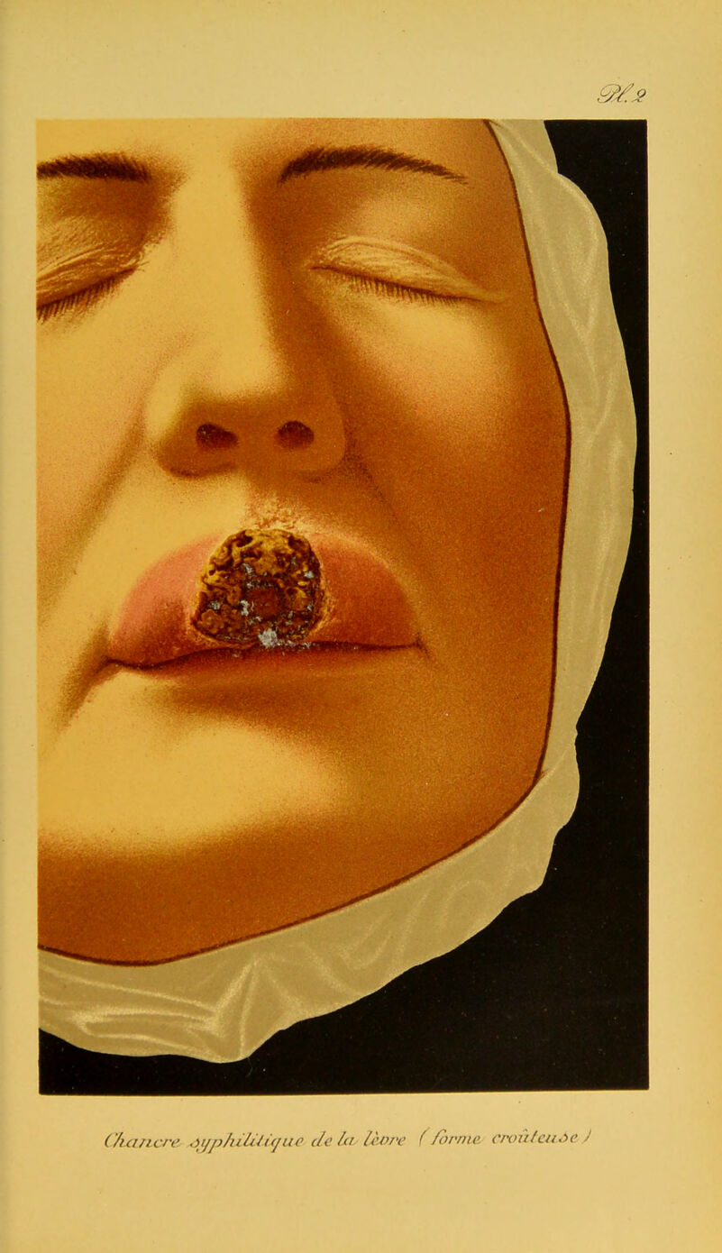 Otancre .>t/p/iililr</ue c/e la Uwre (/orme, cmùlcuôe