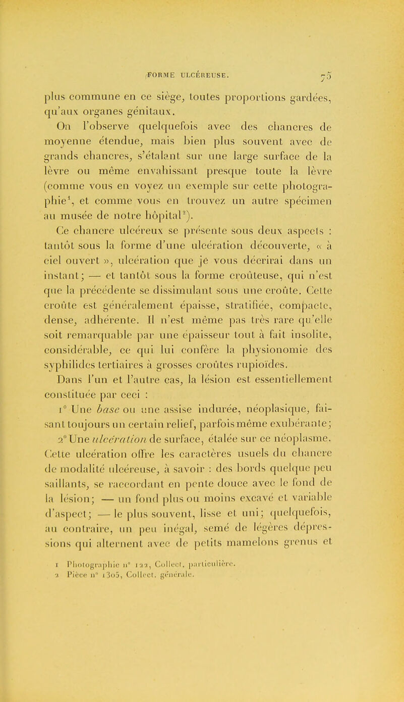 FORME ULCÉREUSE. j5 plus commune en ce siège, toutes proportions gardées, qu'aux organes génitaux. On l'observe quelquefois avec des chancres de moyenne étendue, mais bien plus souvent avec de grands chancres, s'étalant sur une large surface de la lèvre ou même envahissant presque toute la lèvre (comme vous en voyez un exemple sur cette photogra- phie1, et comme vous en trouvez un autre spécimen au musée de notre hôpital2). Ce chancre ulcéreux se présente sous deux aspects : tantôt sous la forme d'une ulcération découverte, « à ciel ouvert », ulcération que je vous décrirai dans un instant; — et tantôt sous la forme croûteuse, qui n'est que la précédente se dissimulant sous une croûte. Celte croule est généralement épaisse, stratifiée, compacte, dense, adhérente, il n'est môme pas très rare qu'elle soit remarquable par une épaisseur tout à fait insolite, considérable, ce qui lui confère la physionomie des syphilides tertiaires à grosses croûtes rupioïdes. Dans l'un et l'autre cas, la lésion est essentiellement constituée par ceci : i° Une base ou une assise indurée, néoplasique, fai- sant toujours un certain relief, parfois même exubérante; 2° Une ulcération de surface, étalée sur ce néoplasme. Celle ulcération offre les caractères usuels du chancre de modalité ulcéreuse, à savoir : des bords quelque peu saillants, se raccordant en pente douce avec le fond de la lésion; — un fond plus ou moins excavé et variable d'aspeel; —le plus souvent, lisse et uni; quelquefois, au contraire, un peu inégal, semé de légères dépres- sions qui alternent avec de petits mamelons grenus et i Photographie n iaa, Collect. particulière, a Pièce n l'joâ, ColU-ct. générale.