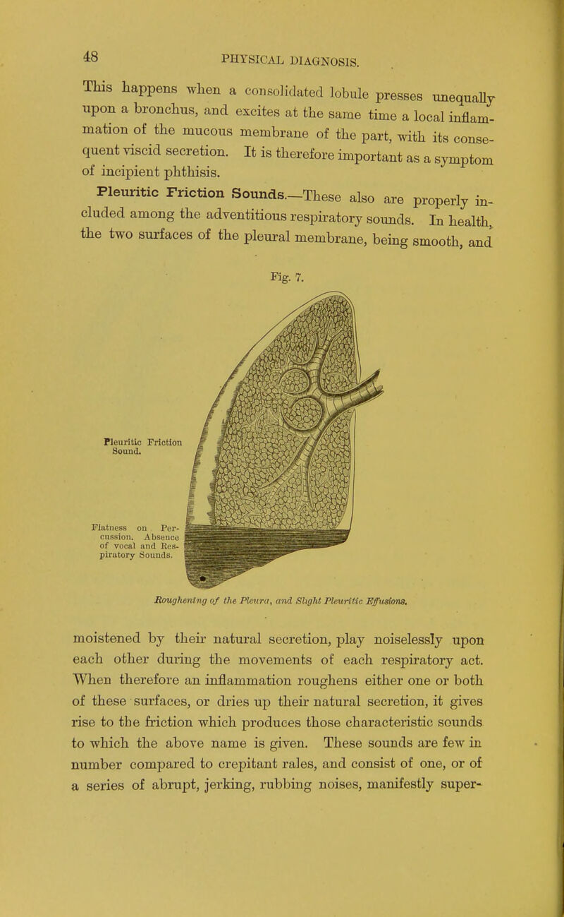 This happens when a consolidated lobule presses nnequallr upon a bronchus, and excites at the same time a local inflam- mation of the mucous membrane of the part, with its conse- quent viscid secretion. It is therefore important as a symptom of incipient phthisis. Pleuritic Friction Sounds.-These also are properly in- cluded among the adventitious respiratory sounds. In health, the two surfaces of the pleural membrane, being smooth, and Fig. 7. Pleuritic Friction Sound. Flatness on Per- cussion. Absence of vocal and Res- piratory Sounds. RotLghening of the Pleura, and Slight Pleuritic Effuskm. moistened by their natural secretion, play noiselessly upon each other during the movements of each respiratory act. When therefore an inflammation roughens either one or both of these surfaces, or dries up their natural secretion, it gives rise to the friction which produces those characteristic sounds to which the above name is given. These sounds are few in number compared to crepitant rales, and consist of one, or of a series of abrupt, jerking, rubbing noises, manifestly super-