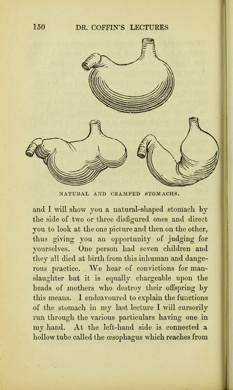 NATURAL AND CRAMPED STOMACHS. and I will show you a natural-shaped stomach by the side of two or three disfigured ones and direct you to look at the one picture and then on the other, thus giving you an opportunity of judging for yourselves. One person had seven children and they all died at birth from this inhuman and dange- rous practice. We hear of convictions for man- slaughter but it is equally chargeable upon the heads of mothers who destroy their offspring by this means. I endeavoured to explain the functions of the stomach in my last lecture I will cursorily run through the various particulars having one in my hand. At the left-hand side is connected a hollow tube called the oesophagus which reaches from