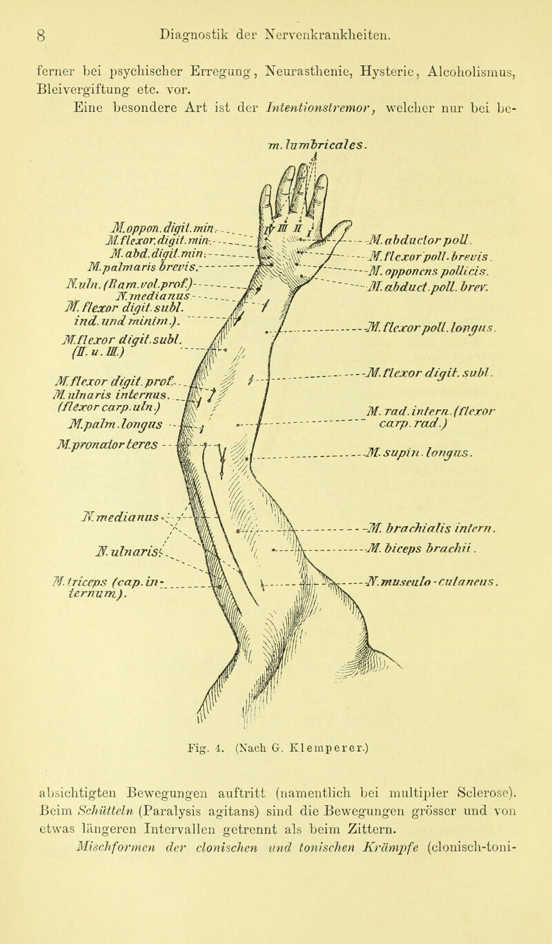 ferner bei psychischer Erregung, Neurasthenie, Hysterie, Alcoholismus, Bleivergiftung etc. vor. Eine besondere Art ist der Intentionstremor, welcher nur bei be- m. lurnbricales. 4 M oppon. äigit. min.- ^. M.flcxoK digit. mirb.- - - M. abd. dl ff it. min -. Mpalmaris hreuis. Ruin. (Ram.i/ol.prof.) Jf.Tnedianus M.flexor digit. subl. ind. undminim.). M.flexor digit. subl (TT. u.M.) M.flexor digit. prof.~ -, M.ulnaris internus (flexor carp.uln.) M. palm. longns M.prmcäorteres - Kmedianus^i M ulnarisi^ W. friceps (cap. in - termiTYi). M.abduciorpoU. -M. flexorpoU. breuis. -M. opponcns poUicis. M.abduct.poli. brev. -M. flexor polt, longiis. - -M. fle.Tor digit. subl. M. rad. intern, (flexor carp.rad.) -M. supin. long US. -M brachialis infern. -M. biceps brachii. JV. mu.9eulo - cutanens. Fig. 4. (Nach G. Klemperer.) absichtigten Bewegungen auftritt (namentlich bei multipler Sclerose). Beim Schütteln (Paralysis agitans) sind die Bewegungen grösser und von etwas längeren Intervallen getrennt als beim Zittern. Mischformen der clonischen und tonischen Krämjyfe (clonisch-toni-