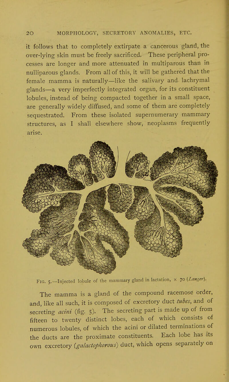 it follows that to completely extirpate a cancerous gland, the over-lying skin must be freely sacrificed. These peripheral pro- cesses are longer and more attenuated in multiparous than in nulliparous glands. From all of this, it will be gathered that the female mamma is naturally—like the salivary and lachrymal glands—a very imperfectly integrated organ, for its constituent lobules, instead of being compacted together in a small space, are generally widely diffused, and some of them are completely sequestrated. From these isolated supernumerary mammary structures, as I shall elsewhere show, neoplasms frequently arise. Fig. 5.—Injected lobule of the mammary gland in lactation, x 70 (Langer). The mamma is a gland of the compound racemose order, and, like all such, it is composed of excretory duct tubes, and of secreting acini (fig. 5). The secreting part is made up of from fifteen to twenty distinct lobes, each of which consists of numerous lobules, of which the acini or dilated terminations of the ducts are the proximate constituents. Each lobe has its own excretory (galactophorous) duct, which opens separately on