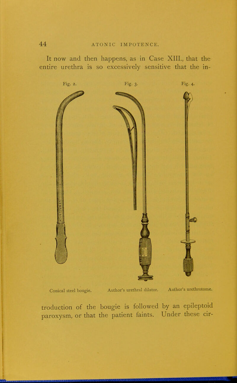 It now and then happens, as in Case XIII., that the entire urethra is so excessively sensitive that the in- Fig. 2. Fig. 3. Fig. 4. Conical steel bougie. Author's urethral dilator. Author's urethrotome. troduction of the bougie is followed by an epileptoid paroxysm, or that the patient faints. Under these cir-