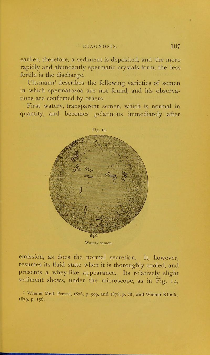 earlier, therefore, a sediment is deposited, and the more rapidly and abundantly spermatic crystals form, the less fertile is the discharge. Ultzmann^ describes the following varieties of semen in which spermatozoa are not found, and his observa- tions are confirmed by others: First watery, transparent semen, which is normal in quantity, and becomes gelatinous immediately after Fig. 14. Watery semen. emission, as does the normal secretion. It, however, resumes its fluid state when it is thoroughly cooled, and presents a whey-like appearance. Its relatively slight sediment shows, under the microscope, as in Fig. 14, 1 Wiener Med. Presse, 1876, p. 599, and 1878, p. 78 ; and Wiener Klinik, 1879, p. 156.