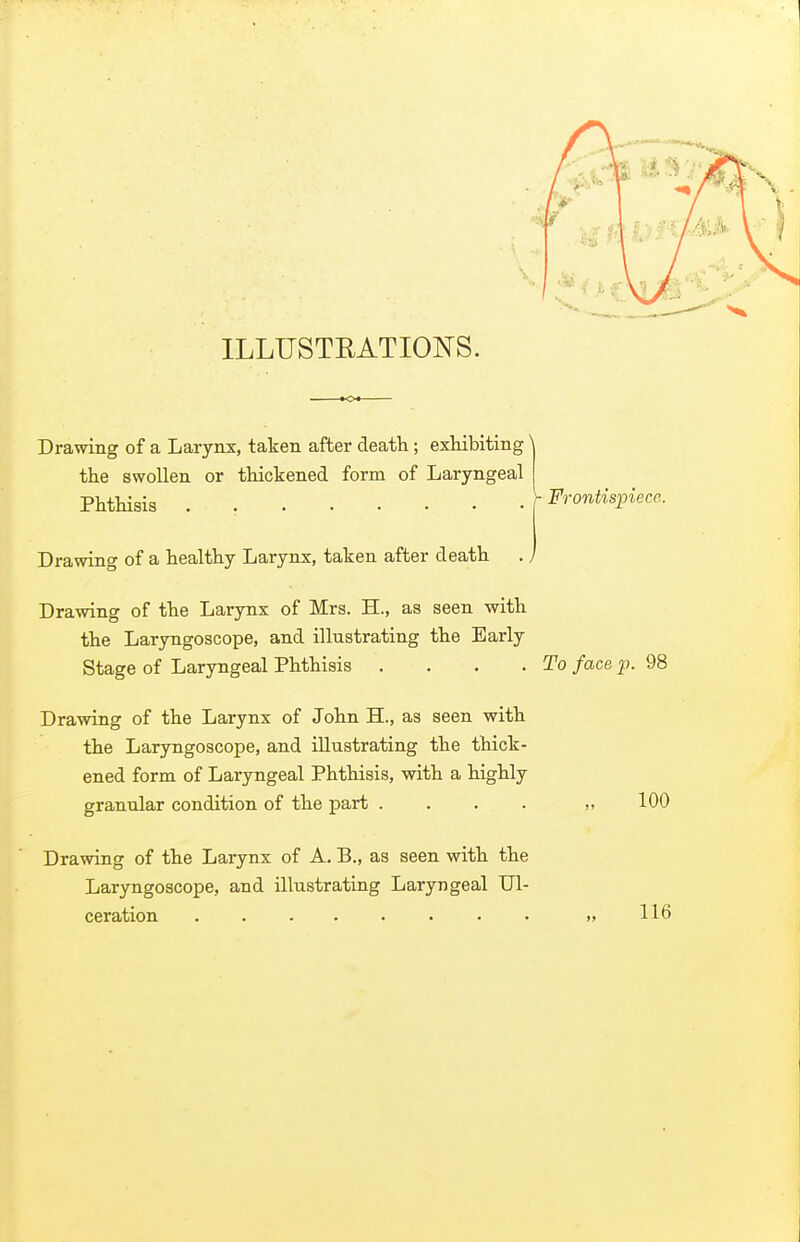 ILLUSTRATIONS. Drawing of a Larynx, taken after death; exhibiting' the swollen or thickened form of Laryngeal PhtHsis . V Frontispiece. Drawing of a healthy Larynx, taken after death . / Drawing of the Larynx of Mrs. H., as seen with the Laryngoscope, and illustrating the Early Stage of Laryngeal Phthisis . . . .To face p. 98 Drawing of the Larynx of John H., as seen with the Laryngoscope, and illustrating the thick- ened form of Laryngeal Phthisis, with a highly granular condition of the part . . . . 100 Drawing of the Larynx of A. B., as seen with the Laryngoscope, and illustrating Laryngeal Ul- ceration » 116