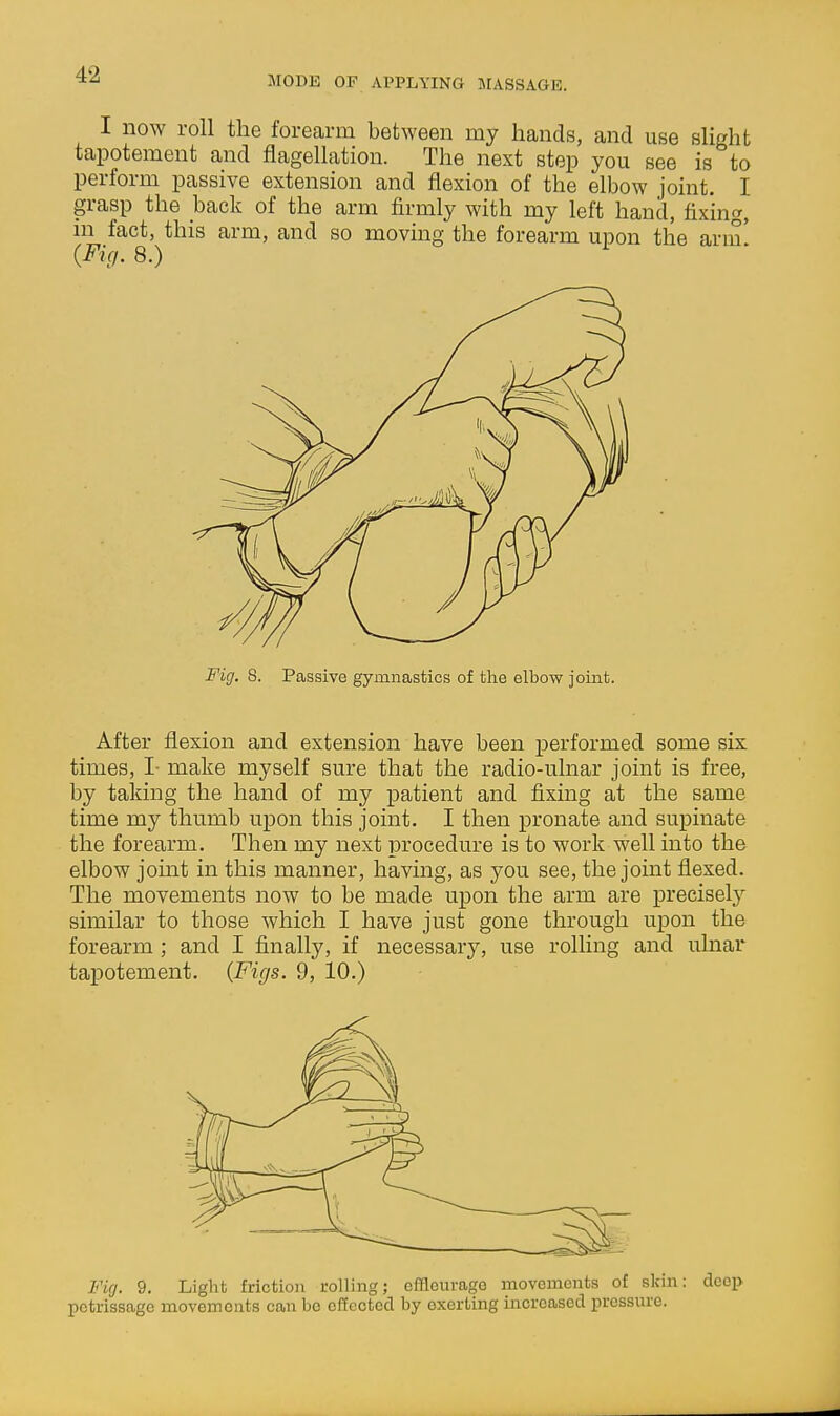 I now roll the forearm between my hands, and use slight tapotement and flagellation. The next step you see is to perform passive extension and flexion of the elbow joint. I grasp the back of the arm firmly with my left hand, fixing, in fact, this arm, and so moving the forearm upon the arm' {Fig, 8.) Fig. 8. Passive gymnastics of the elbow joint. After flexion and extension have been performed some six times, I- make myself sure that the radio-ulnar joint is free, by taking the hand of my patient and fixing at the same time my thumb upon this joint. I then pronate and supinate the forearm. Then my next procedure is to work well into the elbow joint in this manner, having, as you see, the joint flexed. The movements now to be made upon the arm are precisely similar to those which I have just gone through upon the forearm ; and I finally, if necessary, use rolling and ulnar tapotement. {Figs. 9, 10.) Firj. 9. Light friction rolling; efflourage movements of skin: deep petrissage movements can bo clTectecl by exerting increased pressure.