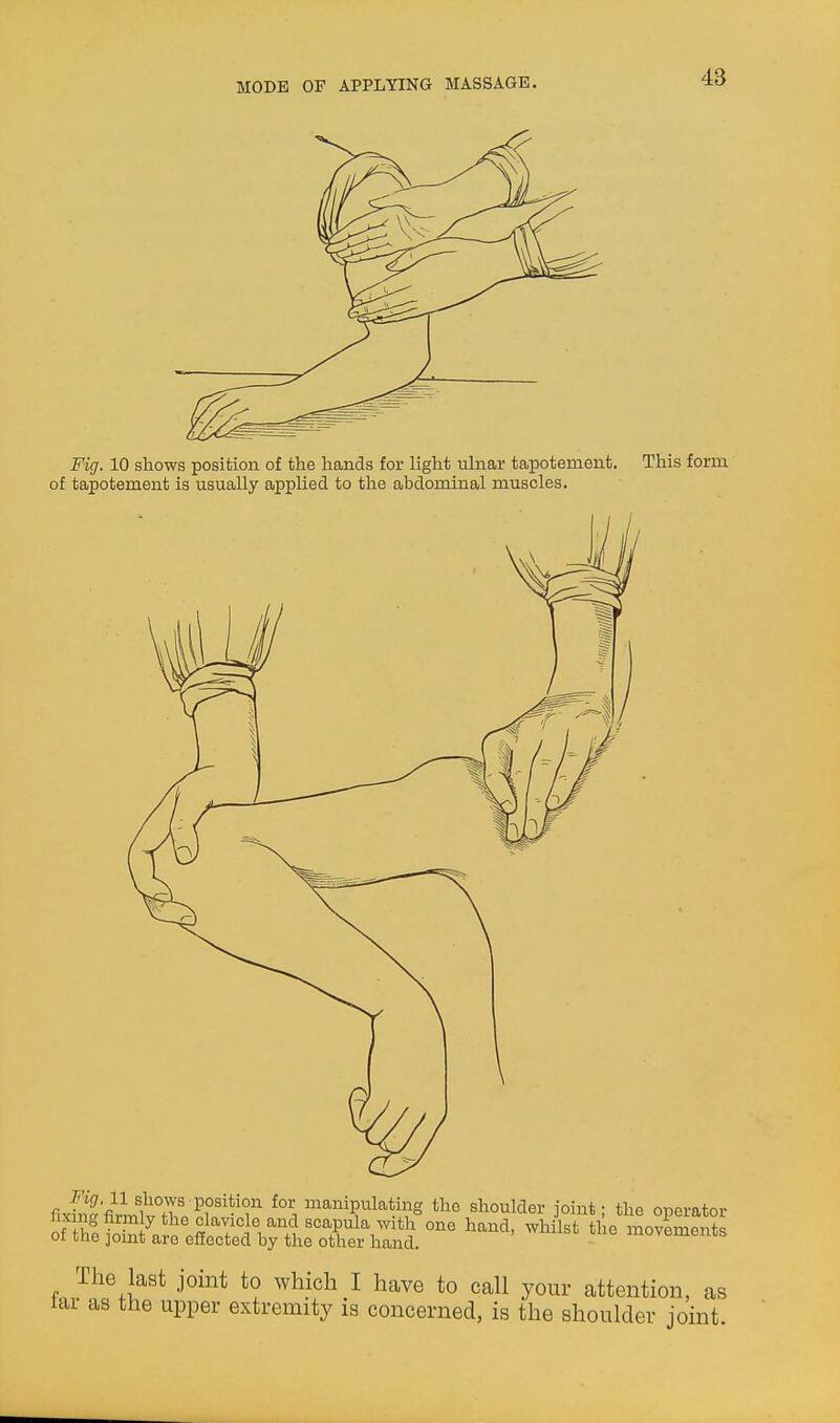 Fig. 10 shows position of the hands for light uhiar tapotement. of tapotement is usually applied to the abdominal muscles. This form fiK5'^fi?mwT«ff manipulating the shoulder joint; the operator oascis^sVyiroX^^^^^^ — The last joint to which I have to call your attention, as lar as the upper extremity is concerned, is the shoulder joint.