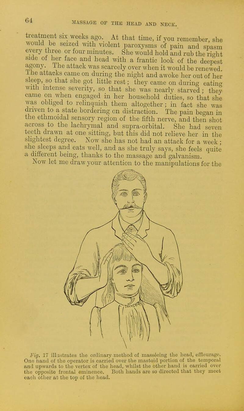 treatment six weeks ago. At that time, if you remember, she wonlcl be seized with violent paroxysms of pain and spasm every three or lour minutes. She would hold and rub the rirrht side ot her lace and head with a frantic look of the deepest agony The attack was scarcely over when it would be renewed lUe attacks came on during the night and awoke her out of her sieep,_so that she got httle rest; they came on during eating with intense severity, so that she was nearly starved; they came on when engaged in her household duties, so that she was obhged to relinquish them altogether; in fact she was driven to a state bordering on distraction. The pain began in the ethmoidal sensory region of the fifth nerve, and then shot across to the lachrymal and supra-orbital. She had seven teeth drawn at one sitting, but this did not relieve her m the shghtest degree. Now she has not had an attack for a week; she sleeps and eats well, and as she truly says, she feels quite a different being, thanks to the massage and galvanism. Now let me draw your attention to the manipulations for the Fig, 17 illastrates the ordinary method of massfieing the head, efllcurago. One liand of the operator is carried over the mastoid portion of the temporal and upwards to the vertex of the liead, whilst the otlier hand is carried over the opposite frontal eminence. Both hands are so directed that they meet each otlier at the top of the head.