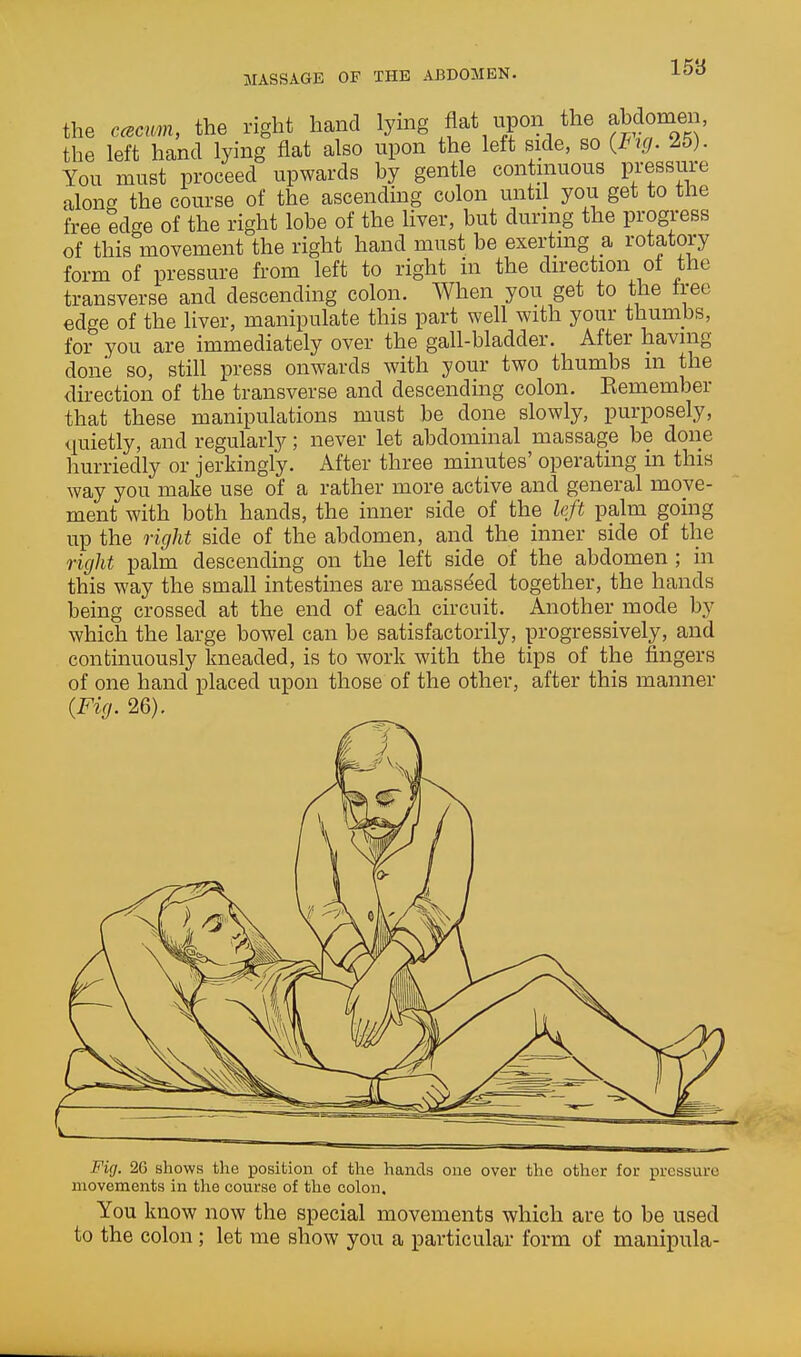 15'6 the ccsam, the right hand h^^^ Vlln the left hand lying flat also upon the left side, so (B^. 25). You must proceed upwards by gentle continuous pressure along the course of the ascending colon until you get to the free edge of the right lobe of the liver, but during the progress of this movement the right hand must be exerting a rotatory form of pressure from left to right in the direction of the transverse and descending colon. When you get to the tree edge of the liver, manipulate this part well with your thumbs, for you are immediately over the gall-bladder. After having done so, still press onwards with your two thumbs m the direction of the transverse and descending colon. Eemember that these manipulations must be done slowly, purposely, quietly, and regularly; never let abdominal massage be done hurriedly or jerkingly. After three minutes' operating in this way you make use of a rather more active and general move- ment with both hands, the inner side of the left palm going up the right side of the abdomen, and the inner side of the right palm descending on the left side of the abdomen ; in this way the small intestines are masseed together, the hands being crossed at the end of each circuit. Another mode by which the large bowel can be satisfactorily, progressively, and continuously kneaded, is to work with the tips of the fingers of one hand placed upon those of the other, after this manner (Fig. 26). Fig. 2G shows the position of the hands one over the other for pressure movements in the course of the colon. You know now the special movements which are to be used to the colon ; let me show you a particular form of manipula-