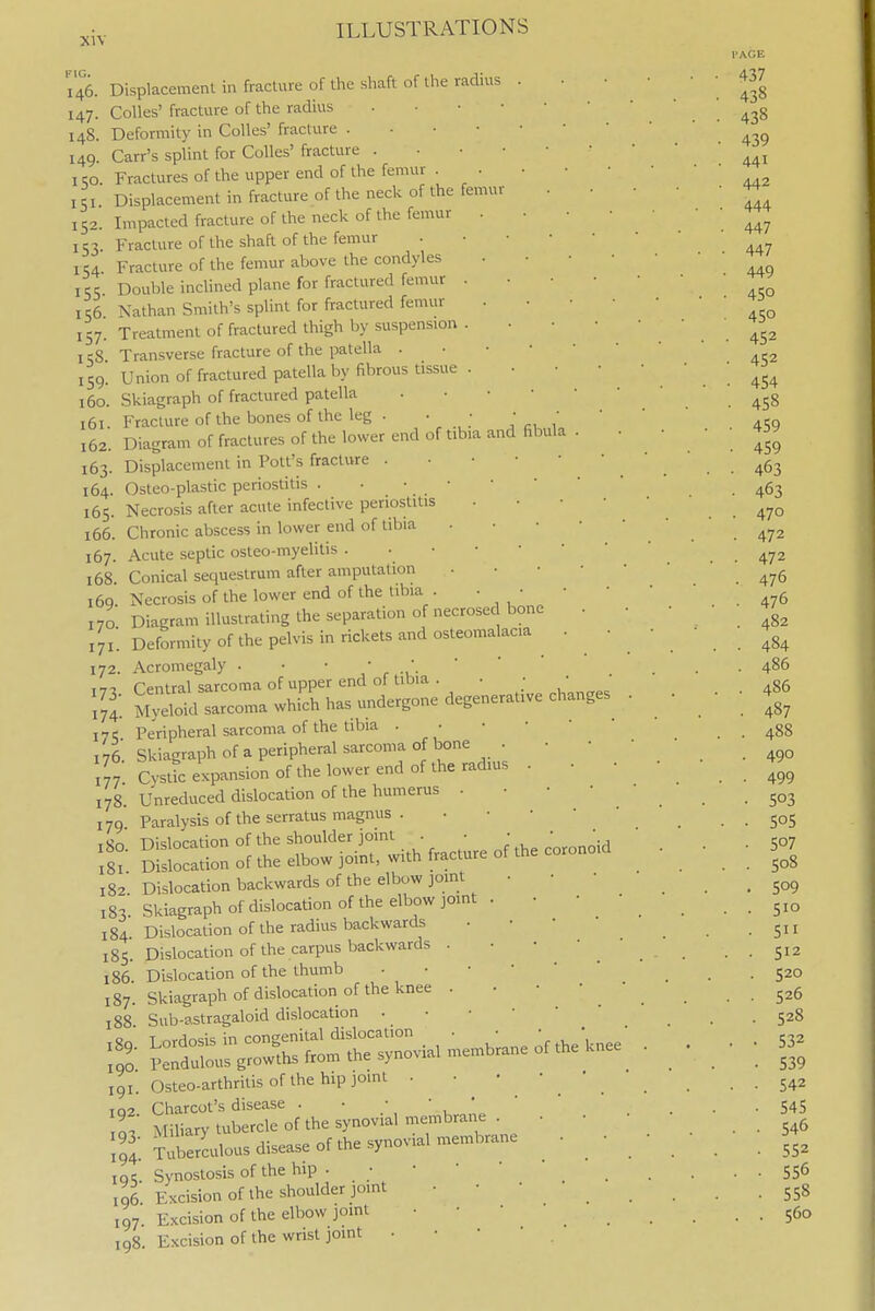146. Displacement in fracture of the shaft of the radius . 147. Colles' fracture of the radius . • • ■ 148. Deformity in Colles' fracture 149. Carr's splint for Colles' fracture . • • • ICO Fractures of the upper end of the femur . 151 Displacement in fracture of the neck of the femur 152. Impacted fracture of the neck of the femur . 153 Fracture of the shaft of the femur 154 Fracture of the femur above the condyles 155 Double inclined plane for fractured femur . 156 \athan Smith's splint for fractured femm- 157. Treatment of fractured thigh by suspension . I cS Transverse fracture of the patella . 159. Union of fractured patella by fibrous tissue . 160. Skiagraph of fractured patella 161. Fracture of the bones of the leg . . • • 162. Diagram of fractures of the lower end of tib.a and fibula 163. Displacement in Pott's fracture . • • • 164. Osteo-plastic periostitis 165. Necrosis after acute infective periostitis 166. Chronic abscess in lower end of tibia 167. Acute septic osteo-myelitis 168. Conical sequestrum after amputation i6q Necrosis of the lower end of the tibia . ■ • 170 Diagram illustrating the separation of necrosed bone 171; Deformity of the pelvis in rickets and osteomalacia 172. Acromegaly . • • • •. 1-71 Central sarcoma of upper end of tibia . • • /74: M>Sd sarcoma which has undergone degenerative changes 17c; Peripheral sarcoma of the tibia . • 176. Skiagraph of a peripheral sarcoma of bone • 177 CystL expansion of the lower end of the radius 178 Unreduced dislocation of the humerus . 179 Paralysis of the scrratus magnus . • • • • 182 Dislocation backwards of the elbow joint • 183 Skiagraph of dislocation of the elbow joint . 184. Dislocation of the radius backwards . • 185. Dislocation of the carpus backwards . 186 Dislocation of the thumb • • • • 187. Skiagraph of dislocation of the knee . 188 Sub-astragaloid dislocation . • • ■ t — 191. Osteo-arthritis of the hip joint . • ■ • • TQ2 Charcot's disease . • ' ,  Miliary tubercle of the synovial membrane . • • Si^rerctilous disease of the synovial membrane . ■ iqc. Synostosis of the hip • • ■ ' 106 Excision of the shoulder pint • • • 197. Excision of the elbow jomt • ■  198. Excision of the wrist joint • • •