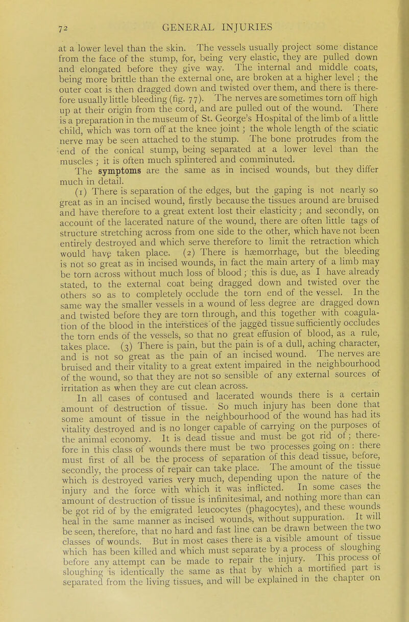 at a lower level than the skin. The vessels usually project some distance from the face of the stump, for, being very elastic, they are pulled down and elongated before they give way. The internal and middle coats, being more brittle than the external one, are broken at a higher level; the outer coat is then dragged down and twisted over them, and there is there- fore usually little bleeding (fig. 77). The nerves are sometimes torn off high up at their origin from the cord, and are pulled out of the wound. There is a preparation in the museum of St. George's Hospital of the limb of a little child which was torn off at the knee joint; the whole length of the sciatic nerve may be seen attached to the stump. The bone protrudes from the end of the conical stump, being separated at a lower level than the muscles ; it is often much splintered and comminuted. The symptoms are the same as in incised wounds, but they differ much in detail. (i) There is separation of the edges, but the gaping is not nearly so great as in an incised wound, firstly because the tissues around are bruised and have therefore to a great extent lost their elasticity; and secondly, on account of the lacerated nature of the wound, there are often little tags of structure stretching across from one side to the other, which have not been entirely destroyed and which serve therefore to limit the retraction which would havg taken place. (2) There is haemorrhage, but the bleeding is not so great as in incised wounds, in fact the main artery of a limb may be torn across without much loss of blood; this is due, as I have already stated, to the external coat being dragged down and twisted over the others so as to completely occlude the torn end of the vessel. In the same way the smaller vessels in a wound of less degree are dragged down and twisted before they are torn through, and this together with coagula- tion of the blood in the interstices of the jagged tissue sufficiently occludes the torn ends of the vessels, so that no great effusion of blood, as a rule, takes place. (3) There is pain, but the pain is of a dull, aching character, and is not so great as the pain of an incised wound. The nerves are bruised and their vitality to a great extent impaired in the neighbourhood of the wound, so that they are not so sensible of any external sources of irritation as when they are cut clean across. In all cases of contused and lacerated wounds there is a certain amount of destruction of tissue. So much injury has been done that some amount of tissue in the neighbourhood of the wound has had its vitality destroyed and is no longer capable of carrying on the purposes ol the animal economy. It is dead tissue and must be got rid of; there- fore in this class of wounds there must be two processes going on : there must first of all be the process of separation of this dead tissue, belore, secondly, the process of repair can take place. The amount of the tissue which is destroyed varies very much, depending upon the nature ot the injury and the force with which it was infficted. In some cases the amount of destruction of tissue is infinitesimal, and nothing more than can be got rid of by the emigrated leucocytes (phagocytes), and these wounds heal in the same manner as incised wounds, without suppuration, it will be seen, therefore, that no hard and fast line can be drawn between the two classes of wounds. But in most cases there is a visible amount ot tissue which has been killed and which must separate by a process of sloughing before any attempt can be made to repair the injury. 1 his proces.s ot sloughing is identically the same as that by which a mortified part is separated from the living tissues, and will be explained in the chapter on