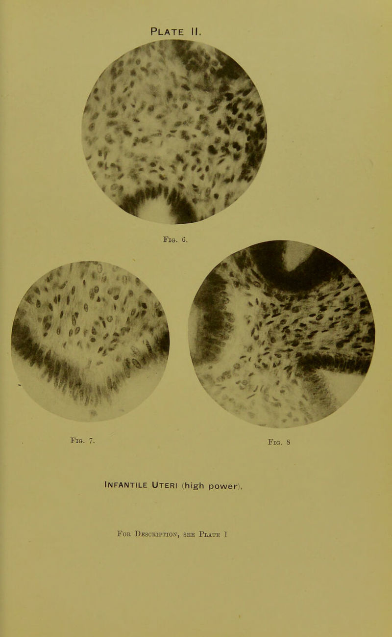 Fig. 7. Fig. 8 Infantile Uteri (high power), Fern Description, see Plate I