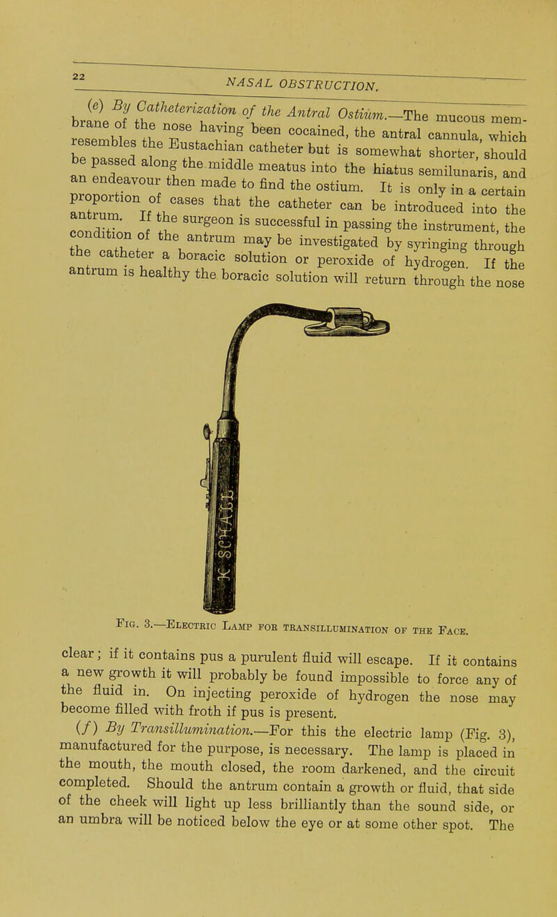 NASAL OBSTRUCTION. brine ff iZ T °*««^-The mucous mem- rZnl ti7\ T8 C°Cained' the antral ca-ula> whieh resembles the Eustachian catheter but is somewhat shorter, should be passed along the middle meatus into the hiatus semilunaris, and an endeavour then made to find the ostium. It is only in a certain aZrVlhCaSeS ^ ^ °atheter ~ be iQt—  LnditTon of * °n 18 SUCCeSSM in paS8inS the instrument, the the I fW Um be ™^tedi by syringing through he catheter a borate solution or peroxide of hydrogen If the antrum is healthy the boracic solution will return through the nose Fig. 3.—Electkic Lamp fob transillumination or the Face. clear; if it contains pus a purulent fluid will escape. If it contains a new growth it will probably be found impossible to force any of the fluid in. On injecting peroxide of hydrogen the nose may become filled with froth if pus is present. (/) By Transillumination.~Fov this the electric lamp (Fig. 3), manufactured for the purpose, is necessary. The lamp is placed in the mouth, the mouth closed, the room darkened, and the circuit completed. Should the antrum contain a growth or fluid, that side of the cheek will light up less brilliantly than the sound side, or an umbra will be noticed below the eye or at some other spot. The