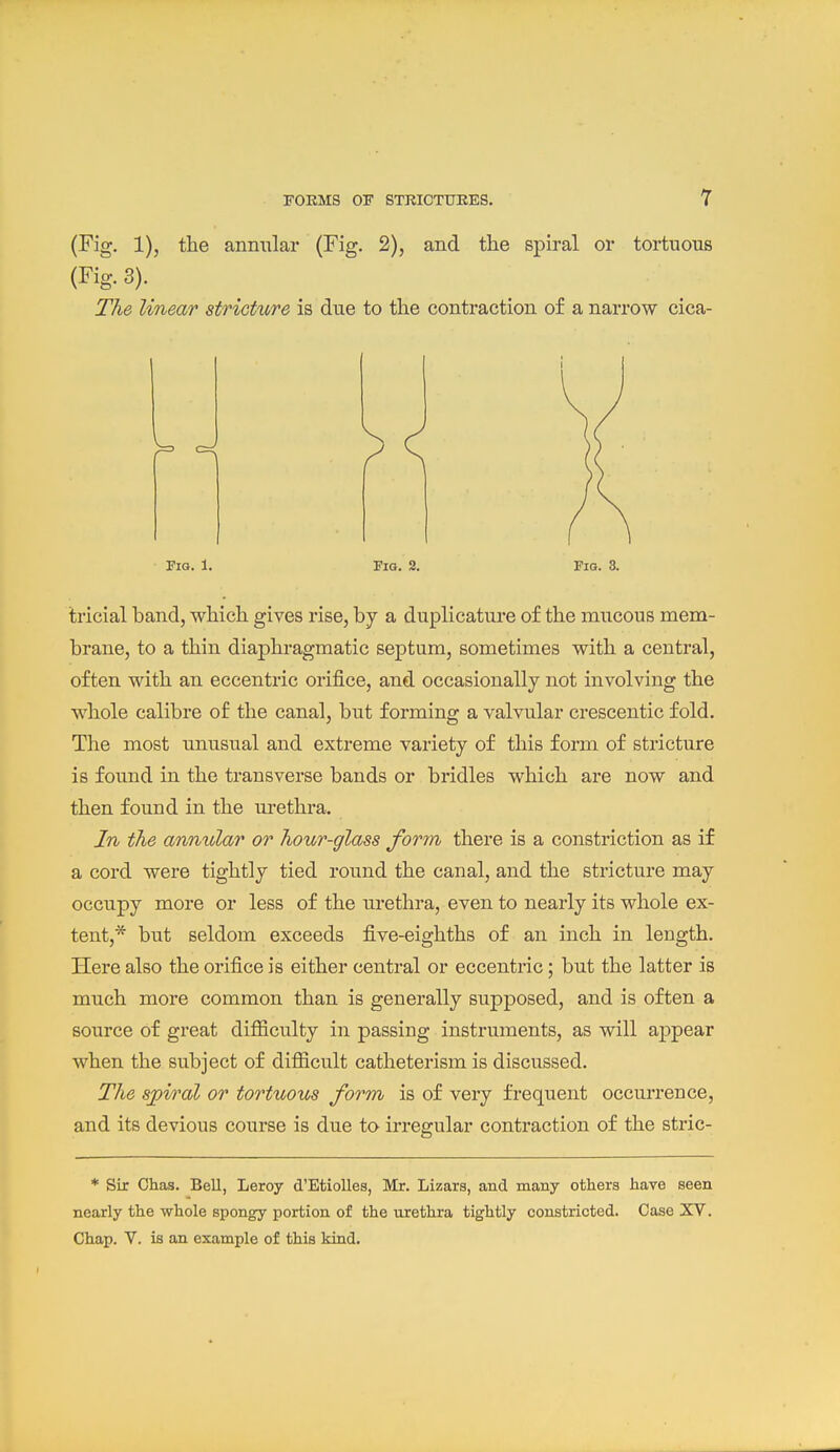 (Fig. 1), the annular (Fig. 2), and the spiral or tortuous (Fig. 3). The linear strictidre is due to the contraction of a narrow cica- Fig. 1. Fig. 2. Fig. 3. tricial band, which gives rise, by a duplicature of the mucous mem- brane, to a thin diaphragmatic septum, sometimes with a central, often with an eccenti-ic orifice, and occasionally not involving the whole calibre of the canal, but forming a valvular crescentic fold. The most unusual and extreme variety of this form of stricture is found in the transverse bands or bridles which are now and then found in the m-ethra. In the anmdar or hour-glass form there is a constriction as if a cord were tightly tied round the canal, and the stricture may occupy more or less of the urethra, even to nearly its whole ex- tent,* but seldom exceeds five-eighths of an inch in length. Here also the orifice is either central or eccentric; but the latter is much more common than is generally supposed, and is often a source of great difficulty in passing instruments, as will aj^pear when the subject of difficult catheterism is discussed. The spiral or tortuous form is of very frequent occurrence, and its devious course is due to irregular contraction of the stric- * Sir Cliag. Bell, Leroy d'EtioUes, Mr. Lizars, and many others have seen nearly the whole spongy portion of the urethra tightly constricted. Case XV. Chap. V. is an example of this kind.