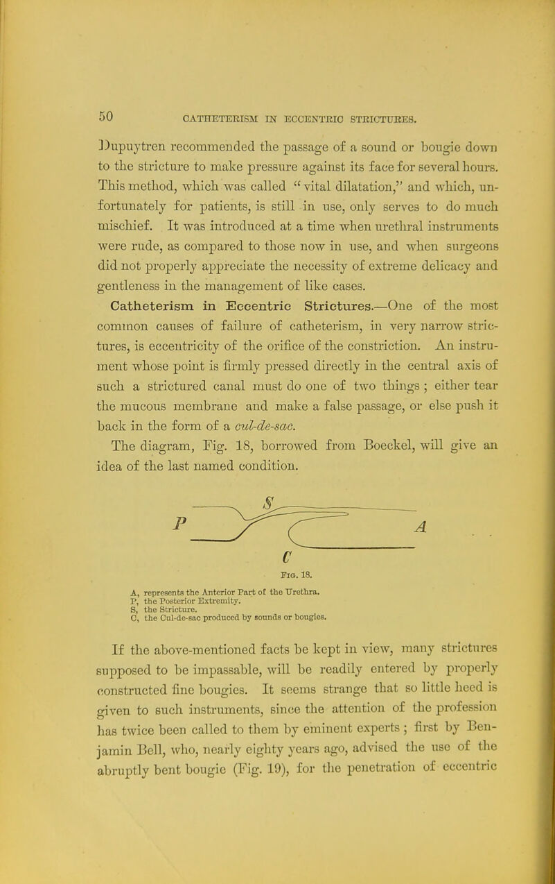 ])iipuytren recommended the passage of a sound or bougie down to the stricture to make pressure against its face for several hours. This method, which was called  vital dilatation, and which, un- fortunately for patients, is still in use, only serves to do much mischief. It was introduced at a time when urethral instruments were rude, as compared to those now in use, and when surgeons did not properly appreciate the necessity of extreme delicacy and gentleness in the management of like cases, Catheterism in Eccentric Strictures.—One of the most common causes of failure of catheterism, in very narrow stric- tures, is eccentricity of the orifice of the constriction. An instru- ment whose point is firmly pressed directly in the central axis of such a strictured canal must do one of two things ; either tear the mucous membrane and make a false passage, or else push it back in the form of a cuL-de-sao. The diagram, Fig. 18, borrowed from Boeckel, will give an idea of the last named condition. c Fia. 18. A, represents the Anterior Part of the Urethra. P, the Posterior Extremity. S, the Stricture. C, the Cul-de-sao produced by sounds or bougies. If the above-mentioned facts be kept in view, many strictures supposed to be impassable, will be readily entered by properly constructed fine bougies. It seems strange that so little heed is given to such instruments, since the attention of the profession has twice been called to them by eminent experts ; fii-st by Ben- jamin Bell, who, nearly eighty years ago, advised the use of the abruptly bent bougie (Fig. 19), for the penetration of eccentric