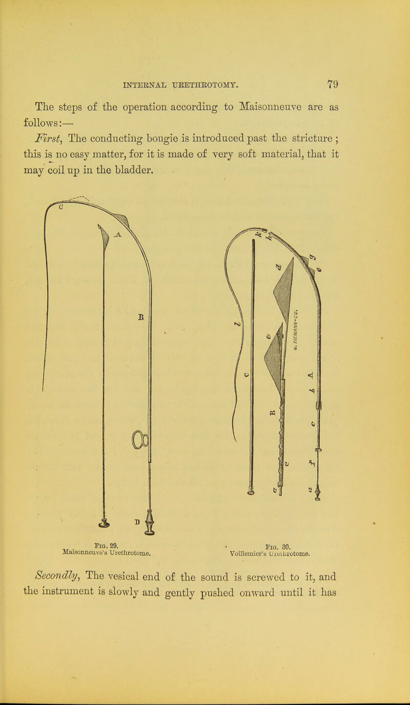 The steps of the operation accordiBg to Maisonneuve are as follows:— First, The conducting bougie is introduced past the stricture ; this is no easy matter, for it is made of very soft material, that it may coil iip in the bladder. Via. 29. . i-iQ. 30. Maisonneuvu's Urethrotome. Voillomior's Uietliiotome. Secondly, The vesical end of the sound is screwed to it, and the instrument is slowly and gently pushed onward until it has