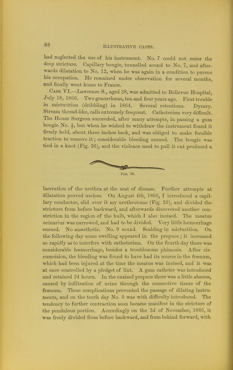 ILLUSTEATIVK CASES. had neglected the use of his instrument. No. 7 could not enter the deep stricture. Capillary bougie, tunnelled sound to No. 7, and after- wards dilatation to No. 12, when he was again in a condition to pursue his occupation. He remained under observation for several months, and finally went home to France. Case VI.—Lawrence S., aged 28, was admitted to Bellevue Hospital, July 18, 1866. Two gonorrhoeas, ten and four years ago. First trouble in micturition (dribbling) in 1864. Several retentions. Dysury. Stream thread-like, calls extremely frequent. Catheterism very difficult. The House Surgeon succeeded, after many attempts, in passing a gum bougie No. ^, but when he wished to withdraw the instrument found it firmly held, about three inches back, and was obliged to make forcible traction to remove it; considerable bleeding ensued. The bougie was tied in a knot (Fig. 36), and the violence used to pull it out produced a Fig. 36. laceration of the urethi-a at the seat of disease. Further attempts at dilatation proved useless. On August 4th, 1866, I introduced a capil- lary conductor, slid over it my urethrotome (Fig. 35), and divided the stricture from before backward, and afterwards discovered another con- striction in the region of the bulb, which I also incised. The meatus urinarius was narrowed, and had to be divided. Very little hajmoiThage ensued. No anaesthetic. No. 9 sound. Scalding in micturition. On the following day some swelling aj^peared in the pi-epuce ; it increased so rapidly as to interfere with catheterism. On the fourth day there was considerable haemorrhage, besides a troublesome phimosis. After cir- cumcision, the bleeding was found to have had its source in the frsenum, which had been injured at the time the meatus was incised, and it was at once controlled by a pledget of lint. A gum catheter was introduced and retained 24 hours. In the excised prepuce there was a little abscess, caused by infiltration of urine through the connective tissue of the fraenum. These complications prevented the passage of dilating instru- ments, and on the tenth day No. 5 was with difficulty introduced. Tlie tendency to further contraction soon became manifest in the stricture of the pendulous portion. Accordingly on the 3d of November, 1860, it was freely divided from before backward, and from behind forward, with