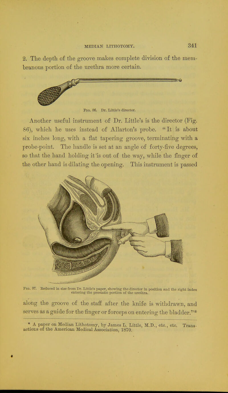 2. The depth of the groove makes complete division of the mem- branous portion of the nrethra more certain. Fig. 86. Dr. Little's director. Another useful instrument of Dr. Little's is the director (Fig. 86), which he uses instead of Allarton's probe. It is about six inches long, with a flat tapering groove, terminating with a probe-point. The handle is set at an angle of forty-five degrees, so that the hand holding it 'is out of the way, while the finger of the other hand is dilating the opening. This instrument is passed Fig. 87. Heduced In size from Dr. Little's paper, showing the director in position nnd the right index entering the prostatic portion of the urethra. along the groove of the staff after the knife is withdrawn, and sei-ves as a guide for the finger or forceps on entering the bladder.* ♦ A paper on Median Lithotomy, by James L. Little, M.D., etc., etc. Trans- actions of the American Medical Association, 1870.