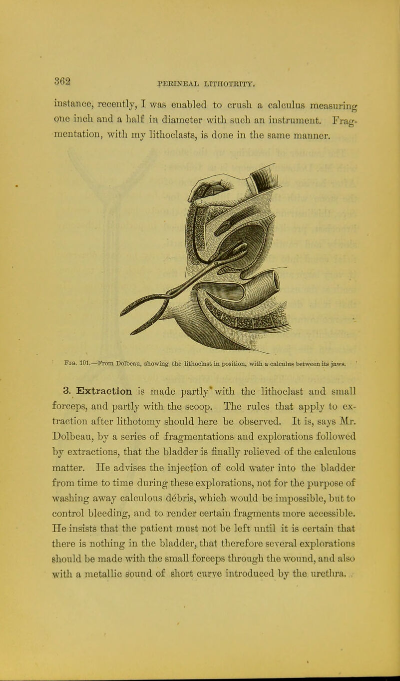 instance, recently, I was enabled to crush a calculus measuring one inch and a half in diameter \dth such an instrument. Frag- mentation, with my lithoclasts, is done in the same manner. Fig. 101.—^From Dolbeau, showing the lithoolast in ix)sition, with a calculnE between its jaws. ' 3. Extraction is made partly*with the lithoclast and small forceps, and partly with the scoop. The rules that apply to ex- traction after lithotomy should here be observed. It is, says Mr. Dolbeau, by a series of fragmentations and explorations followed by extractions, that the bladder is finally relieved of the calculous matter. He advises the injection of cold water into the bladder fi'om time to time during these explorations, not for the purpose of washing away calculous debris, which would be impossible, but to control bleeding, and to render certain fragments more accessible. He insists that the patient must not be left until it is certain that there is nothing in the bladder, that therefore several explorations should be made with the small forceps through the wound, and also with a metallic sound of short curve introduced by the urethra. .