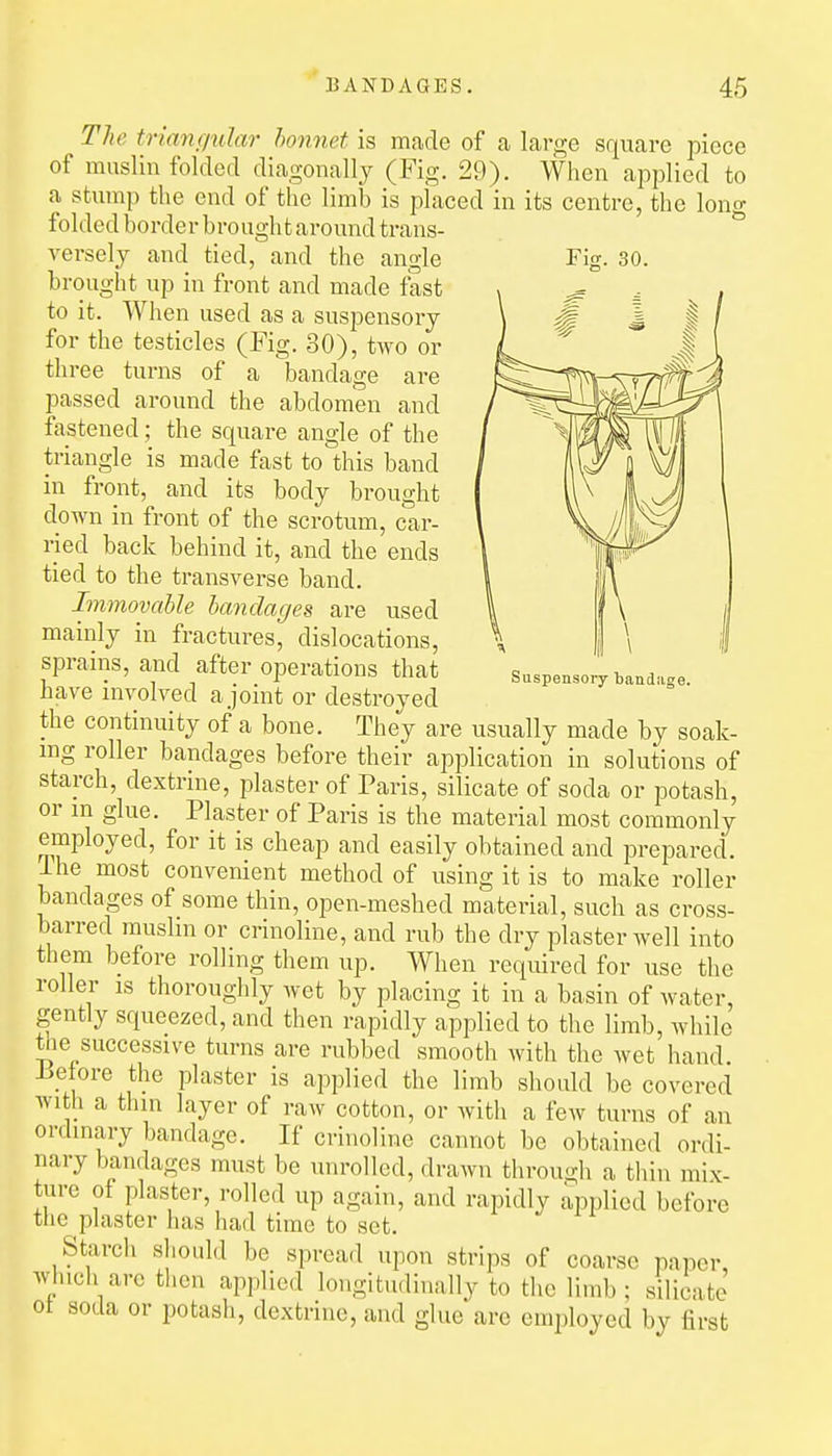 Suspensory bandage. The trianc/tdar honnet is made of a large square piece of muslin folded diagonally (Fig. 29). When applied to a stump the end of the limb is placed in its centre, the long folded border brought around trans- verselj and tied, and the angle Fig. 30. brought up in front and made fast to it. When used as a suspensory for the testicles (Fig. 30), two or three turns of a bandage are passed around the abdomen and fastened; the square angle of the triangle is made fast to this band in front, and its body brought down in front of the scrotum, car- ried back behind it, and the ends tied to the transverse band. Immovable bandages are used mainly in fractures, dislocations, sprains, and after operations that have involved a joint or destroyed the continuity of a bone. They are usually made by soak- mg roller bandages before their application in solutions of starch, dextrine, plaster of Paris, silicate of soda or potash, or in glue. Plaster of Paris is the material most commonly employed, for it is cheap and easily obtained and prepared, ihe most convenient method of using it is to make roller bandages of some thin, open-meshed material, such as cross- barred muslm or crinoline, and rub the dry plaster well into them before rolling them up. When required for use the roller is thoroughly wet by placing it in a basin of water, gently squeezed, and then rapidly applied to the limb, while the successive turns are rubbed smooth with the wet hand -before the plaster is applied the limb should be covered with a thin layer of raw cotton, or with a few turns of an ordinary bandage. If crinoline cannot be obtained ordi- nary bandages must be unrolled, drawn through a thin mix- ture of plaster, rolled up again, and rapidly applied before the plaster has had time to set. Starch should be spread upon strips of coarse paper, which are then applied longitudinally to the limb; silicate ot soda or potash, dextrine, and glue are employed by first