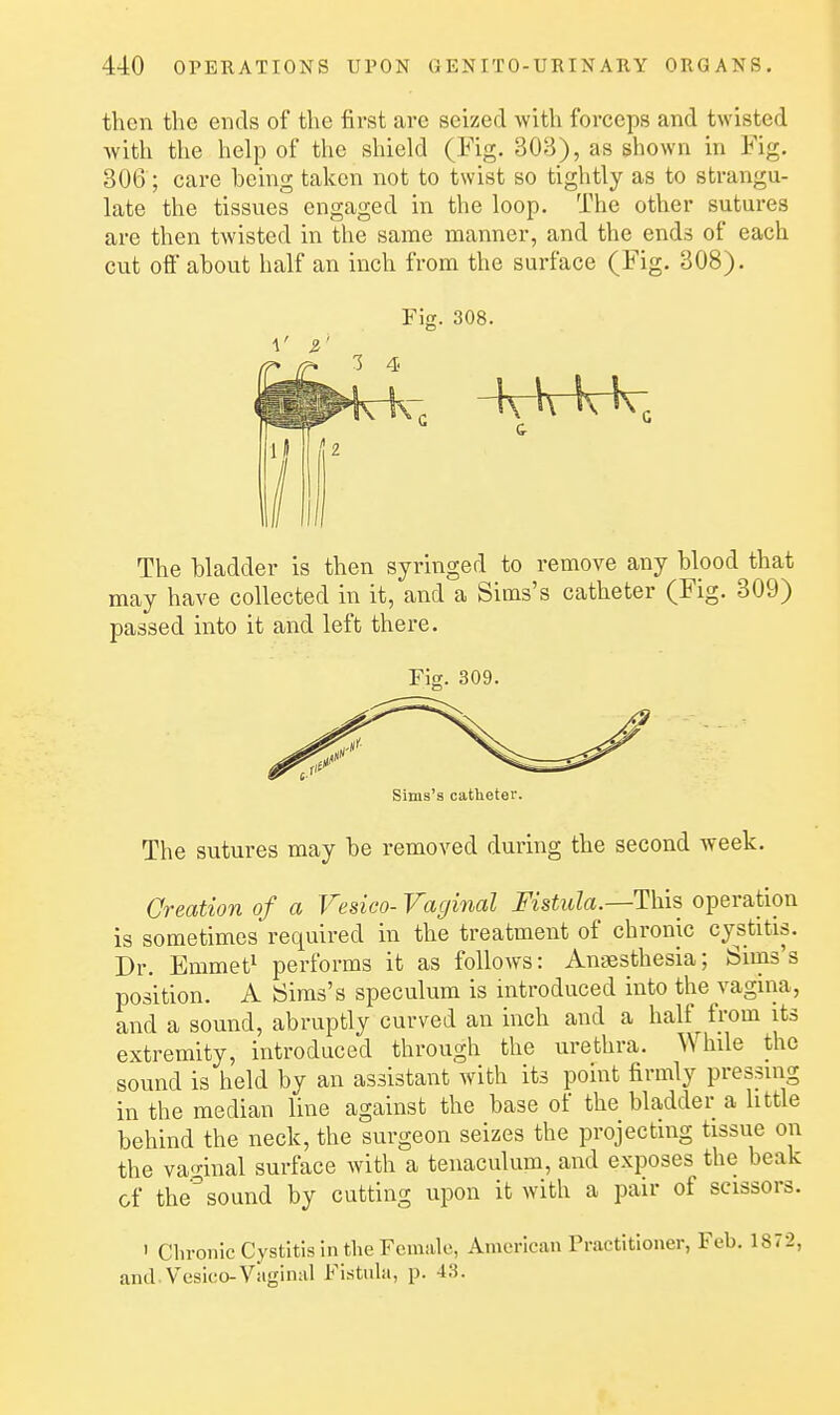 then the ends of the first arc seized with forceps and twisted with the help of the shield (Fig. 308), as shown in Fig. 306; care being taken not to twist so tightly as to strangu- late the tissues engaged in the loop. The other sutures are then twisted in the same manner, and the ends of each cut off about half an inch from the surface (Fig. 308). Fiff. 308. The bladder is then syringed to remove any blood that may have collected in it, and a Sims's catheter (Fig. 309) passed into it and left there. Fig. 309 Sims's catheter. The sutures may be removed during the second week. Creation of a Vesico- Vagirial Fistula.—This operation is sometimes required in the treatment of chronic cystitis. Dr. Emmet^ performs it as follows: Anaesthesia; Sims's position. A Sims's speculum is introduced into the vagina, and a sound, abruptly curved an inch and a half from its extremity, introduced through the urethra. While the sound is held by an assistant with its point firmly pressing in the median line against the base of the bladder a little behind the neck, the surgeon seizes the projecting tissue on the vaginal surface with a tenaculum, and exposes the beak &f the^sound by cutting upon it with a pair of scissors. ' Chronic Cystitis in the Female, American Practitioner, Feb. 1872, and. Vesico-Viigimil Fistuhi, p. 43.