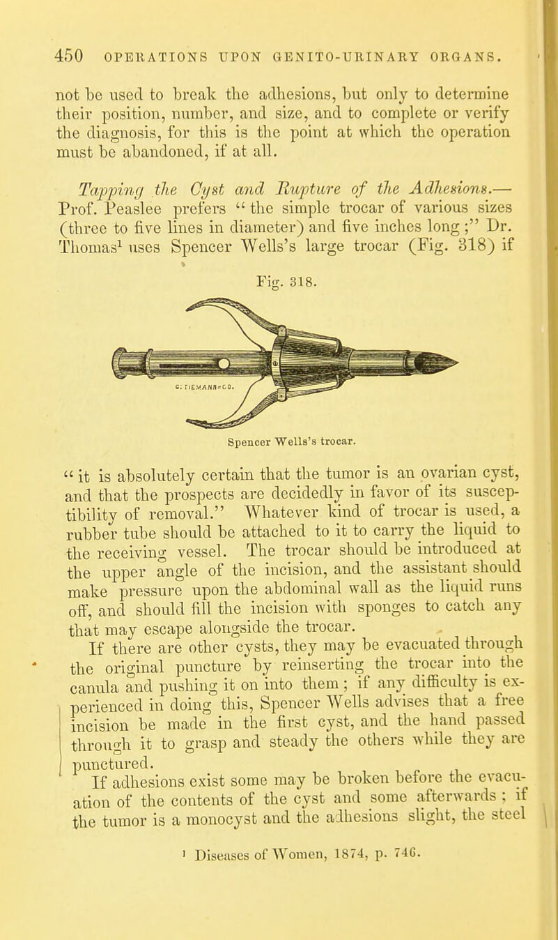 not be used to break the adhesions, but only to determine their position, number, and size, and to complete or verify the diagnosis, for this is the point at which the operation must be abandoned, if at all. Tapjjing the Cyst ayid Rupture of the Adhesions.— Prof. Peaslee prefers  the simple trocar of various sizes (thi-ee to five lines in diameter) and five inches long ; Dr. Thomas^ uses Spencer Wells's large trocar (Fig, 318) if Fig. 318. Spencer WeUs's trocar. it is absolutely certain that the tumor is an ovarian cyst, and that the prospects are decidedly in favor of its suscep- tibility of removal. Whatever kind of trocar is used, a rubber tube should be attached to it to carry the liquid to the receiving vessel. The trocar should be introduced at the upper angle of the incision, and the assistant should make pressure upon the abdominal wall as the liquid runs off, and should fill the incision with sponges to catch any that may escape alongside the trocar. If there are other cysts, they may be evacuated through the original puncture by reinserting the trocar into the canula and pushing it on into them ; if any difficulty is ex- perienced in doing this. Spencer Wells advises that a free incision be made in the first cyst, and the hand passed through it to grasp and steady the others while they are punctured. If adhesions exist some may be broken before the evacu- ation of the contents of the cyst and some afterwards ; if the tumor is a monocyst and the adhesions slight, the steel