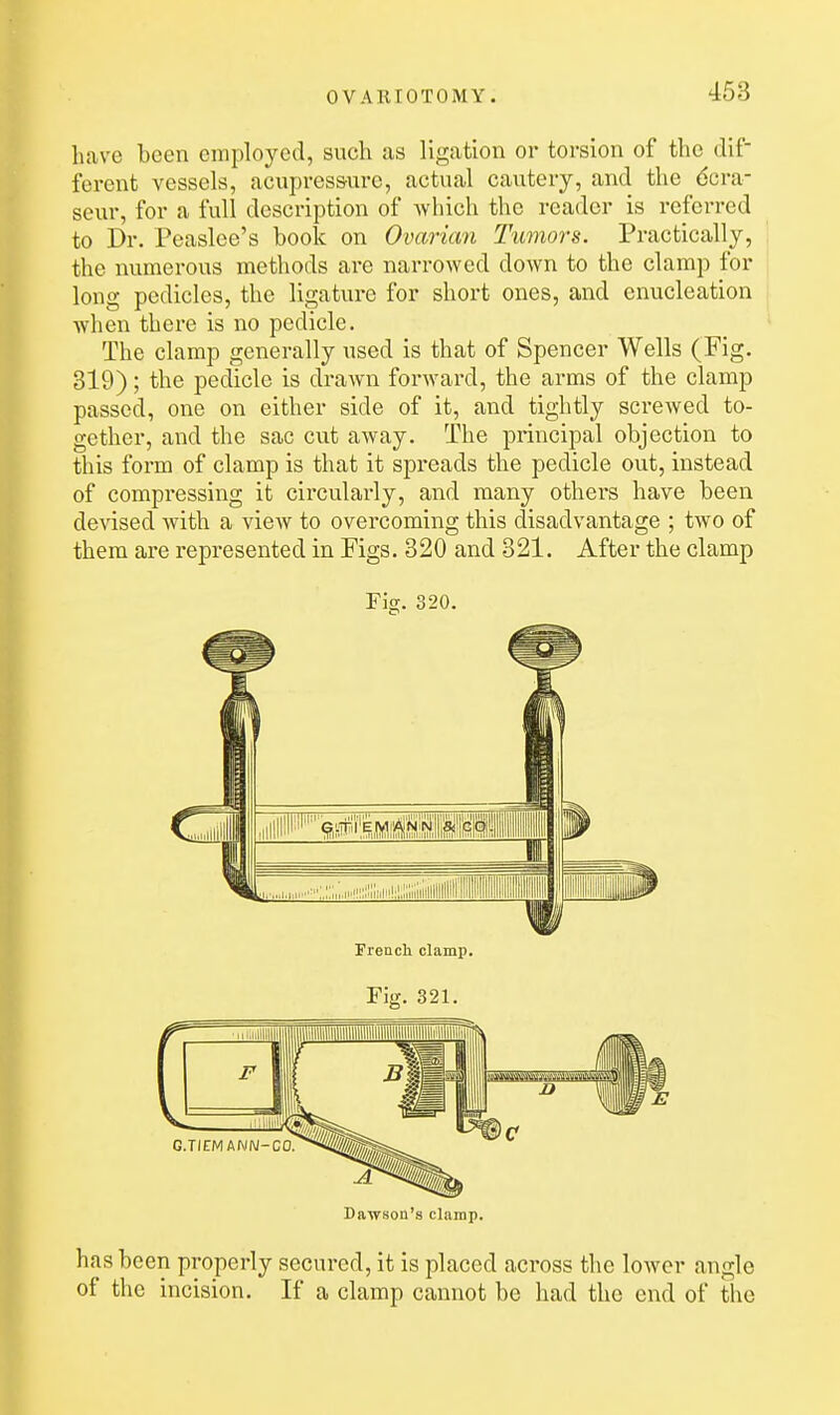have been employed, such as ligation or torsion of the dif- ferent vessels, acupressure, actual cautery, and the dcra- seur, for a full description of which the reader is referred to Dr. Peaslee's book on Ovarian Tumors. Practically, the numerous methods are narrowed down to the clamp for long pedicles, the ligature for short ones, and enucleation when there is no pedicle. The clamp generally used is that of Spencer Wells (Fig. 319); the pedicle is drawn forward, the arms of the clamp passed, one on either side of it, and tightly screAved to- gether, and the sac cvit away. The principal objection to this form of clamp is that it spreads the pedicle out, instead of compressing it circularly, and many others have been devised with a vieAV to overcoming this disadvantage ; two of them are represented in Figs. 320 and 321. After the clamp Fig. 320. Freuch clamp. Fig. 321. Dawson's clamp. has been properly secured, it is placed across the lower angle of the incision. If a clamp cannot be had the end of the