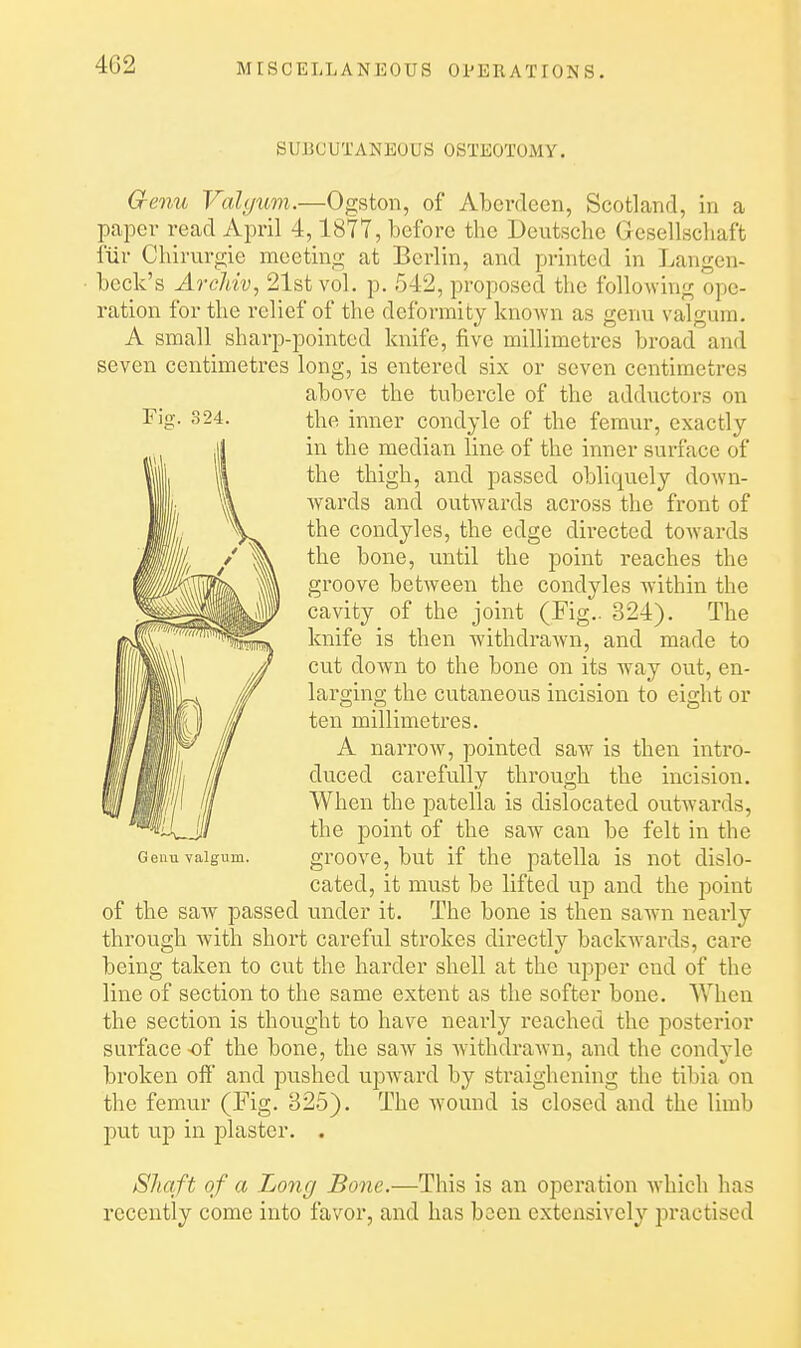 SUBCUTANEOUS OSTEOTOMY. Q-enu Valijum.—Ogston, of Aberdeen, Scotland, in a paper read April 4,1877, before the Deutsche Gesellscliaft fur Chirurgie meeting at Berlin, and printed in Langen- • beck's ArcJdv, 21st vol. p. 542, proposed the following ope- ration for the relief of the deformity known as genu valgum. A small sharp-pointed knife, five millimetres broad and seven centimetres long, is entered six or seven centimetres above the tubercle of the adductors on the inner condyle of the femur, exactly in the median line of the inner surface of the thigh, and passed obliquely down- wards and outwards across the front of the condyles, the edge directed towards the bone, until the point reaches the groove between the condyles within the cavity of the joint (Fig.. 324). The knife is then withdrawn, and made to cut down to the bone on its way out, en- larging the cutaneous incision to eight or ten millimetres. A narrow, pointed saw is then intro- duced carefully through the incision. When the patella is dislocated outwards, the point of the saw can be felt in the Genu valgum. groovo, but if the patella is not dislo- cated, it must be lifted up and the point of the saw passed under it. The bone is then sawn nearly through with short careful strokes directly backwards, care being taken to cut the harder shell at the uj^per end of the line of section to the same extent as the softer bone. When the section is thought to have nearly reached the posterior surface of the bone, the saw is Avithdrawn, and the condjde broken oft and pushed upward by straighcning the tibia on the femur (Fig. 325). The wound is closed and the limb put up in plaster. . Shaft of a Long Bone.—This is an operation which has recently come into favor, and has been extensively practised