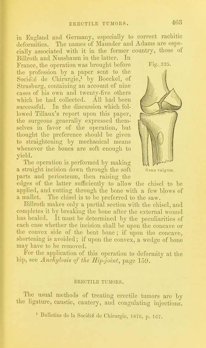 ERECTILE TUMORS. in England and Germany, especially to cori-ect rachitic deformities. The names of Maunder and Adams are espe- cially associated with it in the former country, those of Billroth and Nussbaum in the latter. In Franco, the operation was brought before the profession by a paper sent to the Socie::e de Chirurgic,^ by Boeckel, of Strasburg, containing an account of nine cases of his own and twenty-five others which he had collected. All had been successful. In the discussion which fol- lowed Tillaux's report upon this paper, the sui-geons generally expressed them- selves in favor of the operation, but thought the preference should be given to straightening by mechanical means whenever the bones are soft enough to yield. The operation is performed by making a straight incision down through the soft ceuu valgum, parts and periosteum, then raising the edges of the latter sufficiently to allow the chisel to be applied, and cutting through the bone with a few blows of a mallet. The chisel is to be preferred to the saw. Billroth makes only a partial section with the chisel, and completes it by breaking the bone after the external wound has healed. It must be determined by the peculiarities of each case whether the incision shall be upon the concave or the convex side of the bent bone ; if upon the concave, shortening is avoided; if upon the convex, a wedge of bone may have to be removed. _ For the application of this operation to deformity at the hip, see AncKylosis of the ITijj-jomt, page 159. ERECTILE TUMORS. The usual methods of treating erectile tumors are by the ligature, caustic, cautery, and coagulating injections. ' Bullctms do la Soci6t6 de Chirurgio, 1870, p. 107.