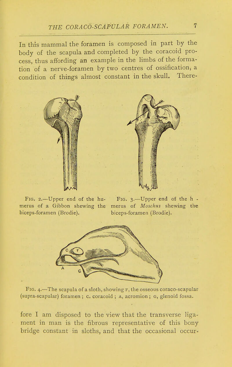 In this mammal the foramen is composed in part by the body of the scapula and completed by the coracoid pro- cess, thus affording an example in the limbs of the forma- tion of a nerve-foramen by two centres of ossification, a condition of things almost constant in the skull. There- FiG. 2.—Upper end of the hu- Fig. 3.—Upper end of the h - merus of a Gibbon shewing the merus of Moschus shewiag the biceps-foramen (Brodie), biceps-foramen (Brodie). Fig. 4.—The scapula of a sloth, showing f, the osseous coraco-scapular (supra-scapular) foramen ; c. coracoid ; a, acromion ; g, glenoid fossa. fore I am disposed to the view that the transverse liga- ment in man is the fibrous representative of this bony bridge constant in sloths, and that the occasional occur-