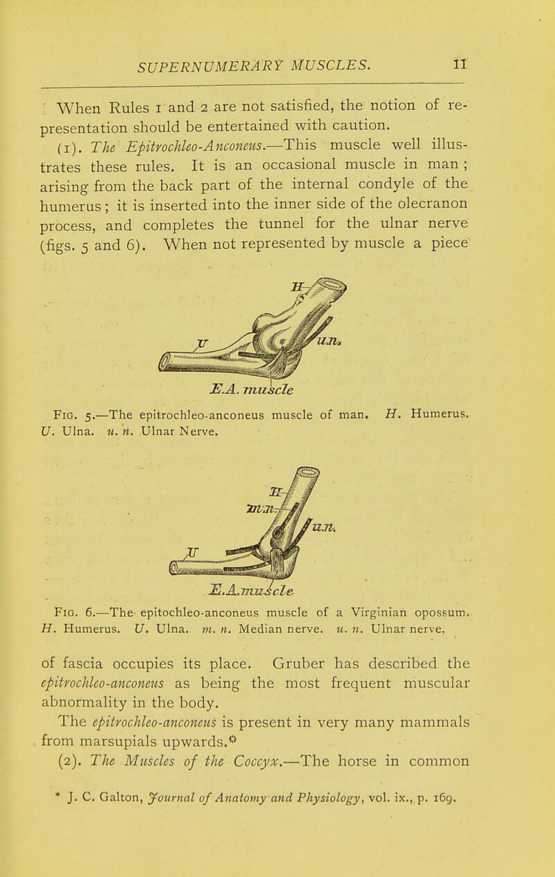 : When Rules i and 2 are not satisfied, the notion of re- presentation should be entertained with caution. (i). The Epitrochleo-Anconeus.—This muscle well illus- trates these rules. It is an occasional muscle in man ; arising from the back part of the internal condyle of the humerus; it is inserted into the inner side of the olecranon process, and completes the tunnel for the ulnar nerve (figs. 5 and 6). When not represented by muscle a piece JS.A. muscle Fig. 5.—The epitrochleo-anconeus muscle of man. H. Humerus. U. Ulna. M. n. Ulnar Nerve. Fig. 6.—The^ epitochleo-anconeus muscle of a Virginian opossum. H. Humerus. U, Ulna. m. n. Median nerve, u. n. Ulnar nerve. of fascia occupies its place. Gruber has described the epitrochleo-anconeus as being the most frequent muscular abnormality in the body. The epitrochleo-anconeus is present in very many mammals from marsupials upwards.'-'* (2). The Muscles of the Coccyx.—The horse in common * J. C. Gallon, Journal of Anatomy and Physiology, vol. ix., p. 169.