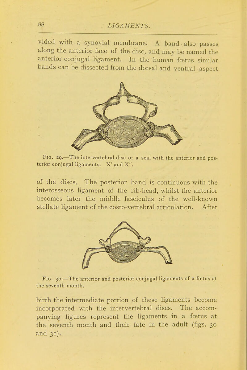 vided with a synovial membrane. A band also passes along the anterior face of the disc, and may be named the anterior conjugal ligament. In the human foetus similar bands can be dissected from the dorsal and ventral aspect Fig. 2g.—The intervertebral disc ot a seal with the anterior and pos- terior conjugal ligaments. X' and X. of the discs. The posterior band is continuous with the interosseous ligament of the rib-head, whilst the anterior becomes later the middle fasciculus of the well-known stellate ligament of the costo-vertebral articulation. After Fig. 30.—The anterior and posterior conjugal ligaments of a foetus at the seventh month. birth the intermediate portion of these ligaments become incorporated with the intervertebral discs. The accom- panying figures represent the ligaments in a foetus at the seventh month and their fate in the adult (figs. 30 and 31).