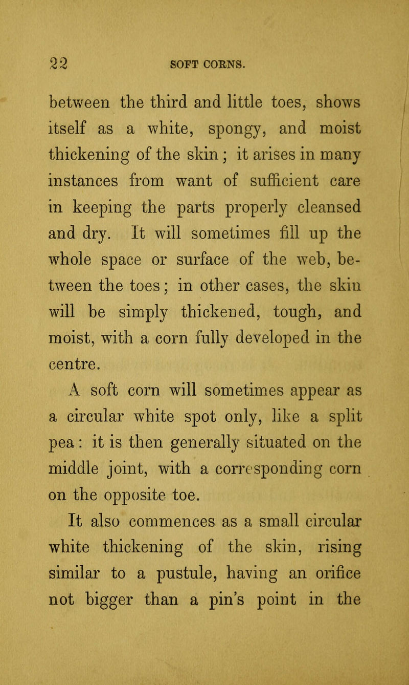 betvv^een the third and Httle toes, shows itself as a white, spongy, and moist thickening of the skin; it arises in many instances from want of sufficient care in keeping the parts properly cleansed and dry. It will sometimes fill up the whole space or surface of the web, be- tween the toes; in other cases, the skin will be simply thickened, tough, and moist, with a corn fully developed in the centre. A soft corn will sometimes appear as a circular white spot only, like a split pea: it is then generally situated on the middle joint, with a corresponding corn on the opposite toe. It also commences as a small circular white thickening of the skin, rising similar to a pustule, having an orifice not bigger than a pin's point in the