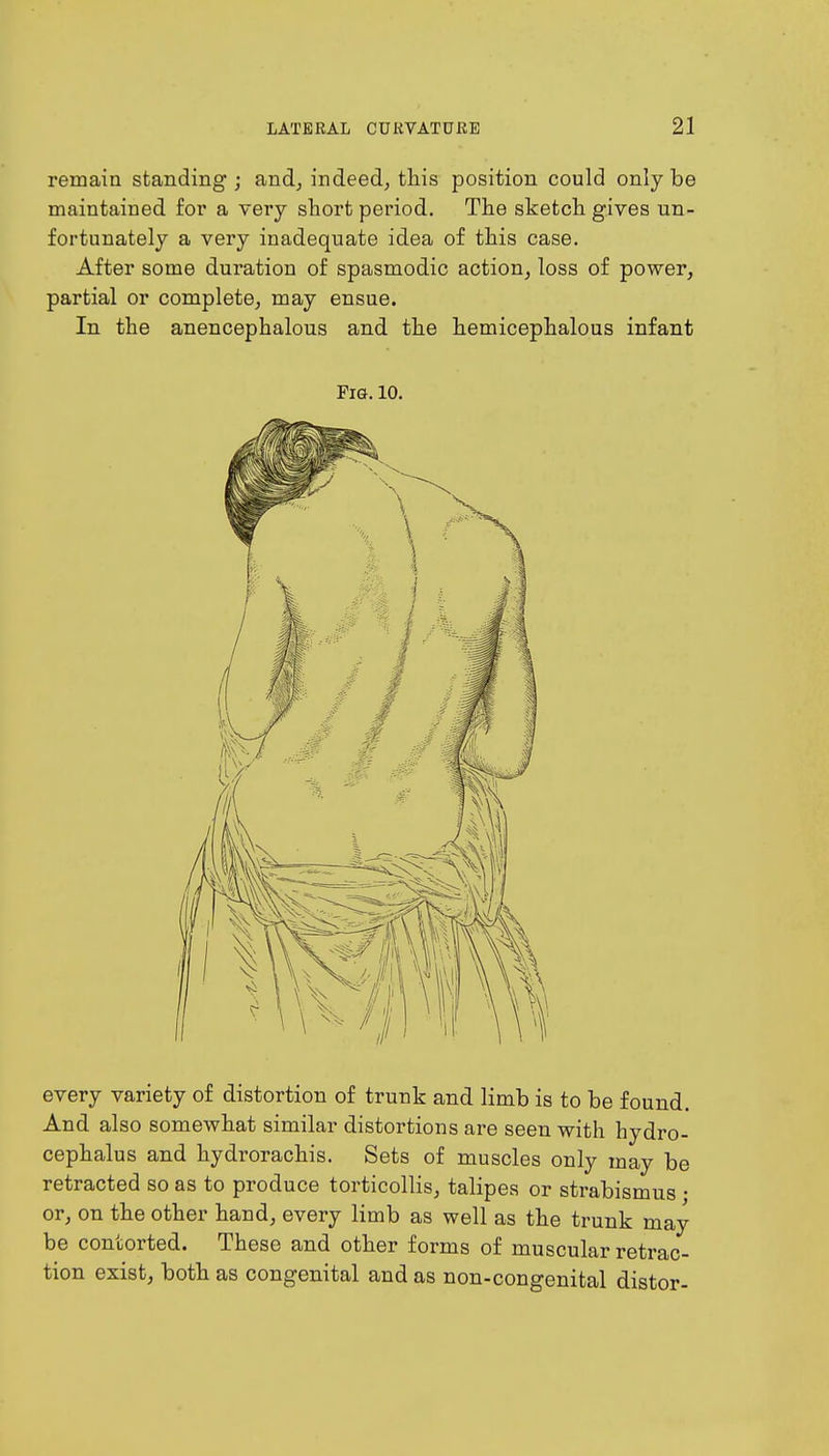 remain standing ; and, indeed, this position could only be maintained for a very short period. The sketch gives un- fortunately a very inadequate idea of this case. After some duration of spasmodic action, loss of power, partial or complete, may ensue. In the anencephalous and the hemicephalous infant Fig. 10. every variety of distortion of trunk and limb is to be found. And also somewhat similar distortions are seen with hydro- cephalus and hydrorachis. Sets of muscles only may be retracted so as to produce torticollis, talipes or strabismus • or, on the other hand, every limb as well as the trunk may be contorted. These and other forms of muscular retrac- tion exist, both as congenital and as non-congenital distor-